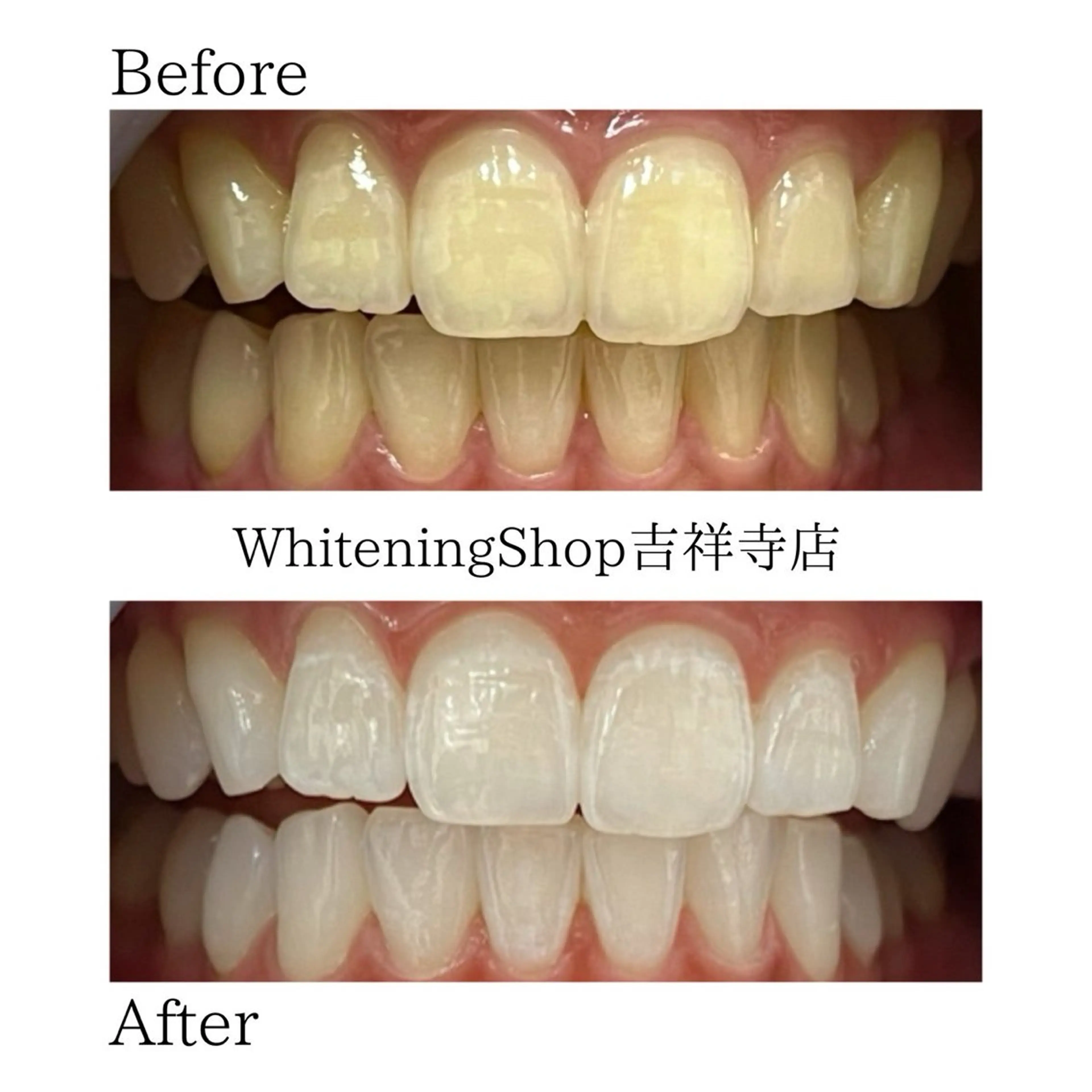 エステ リラク ホワイトニング ショップ吉祥寺店のエステ・リラクイメージ