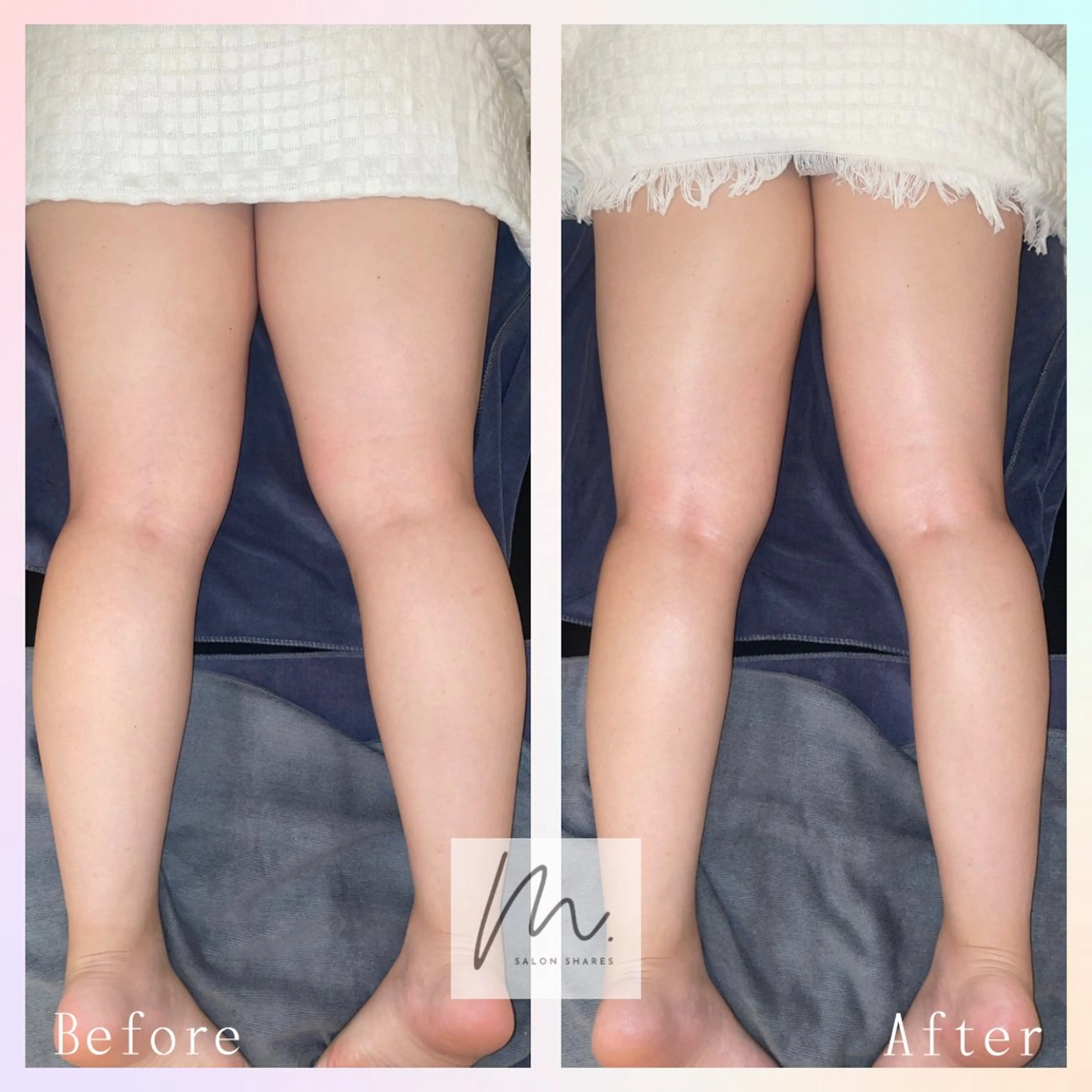 SHARES MADOKAのエステ・リラクイメージ