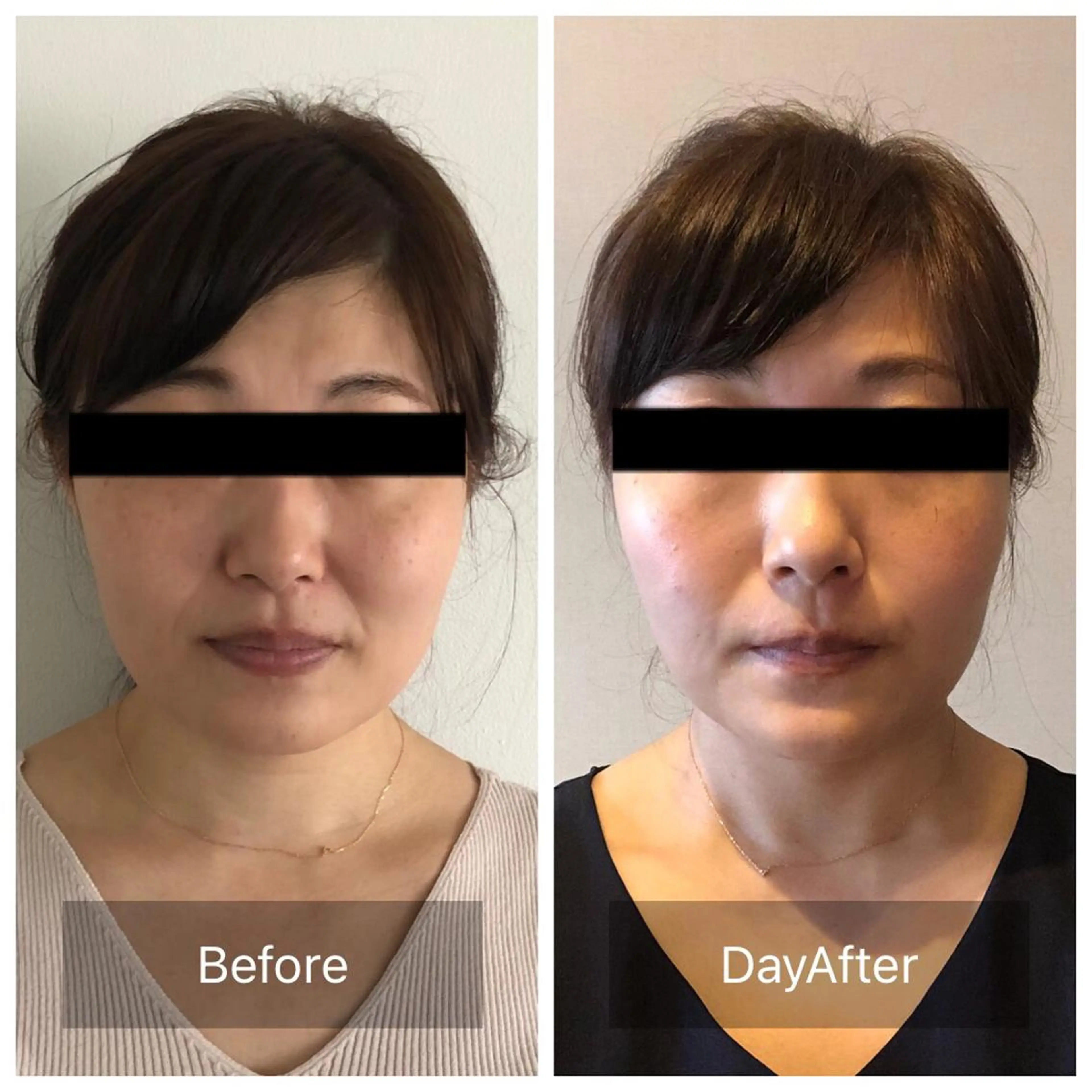 Radiance H.Oのエステ・リラクイメージ