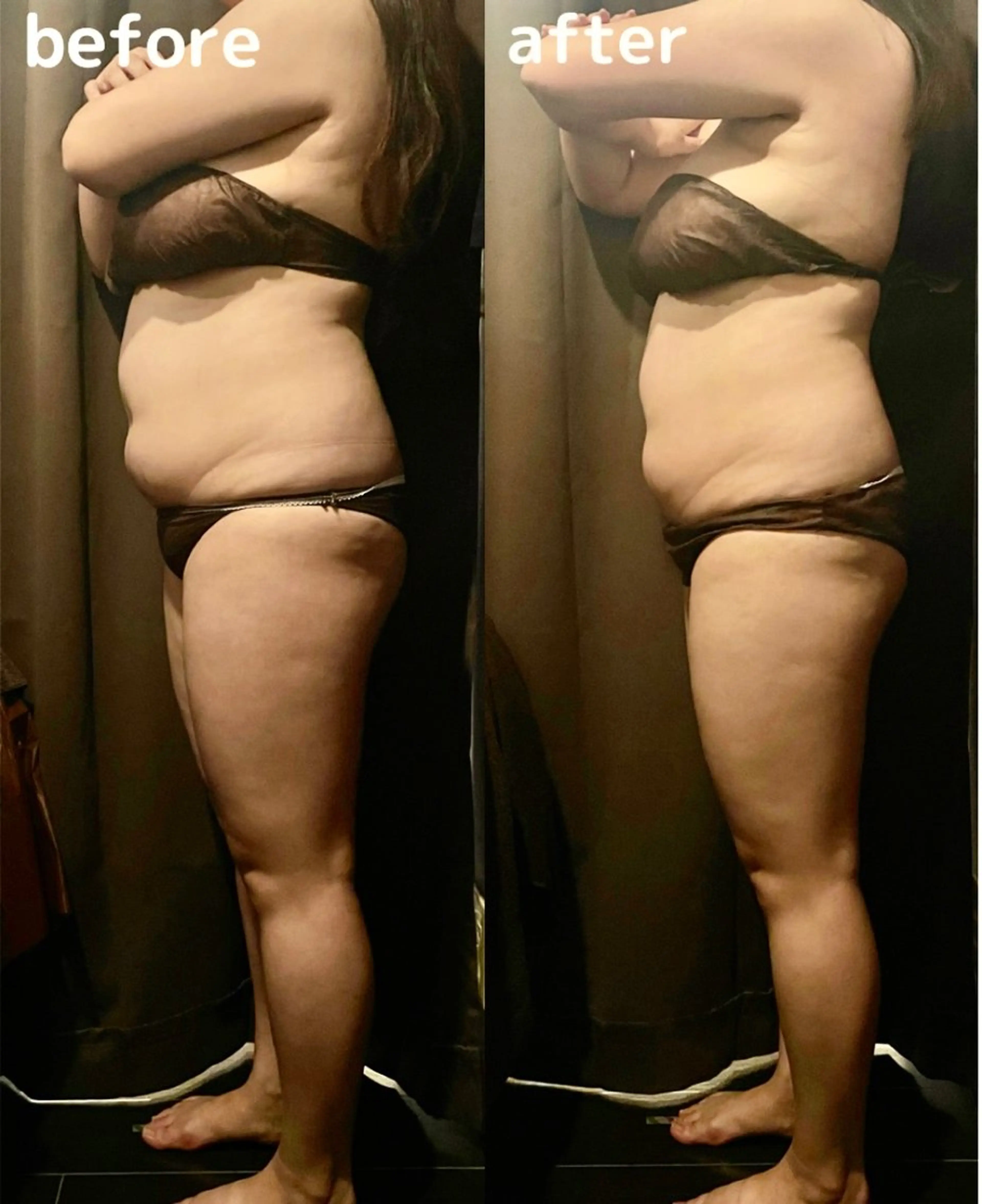 エステ 痩身・フェイシャル/if  byOrabriller所属・if byOrab riller【ｲﾌ】のその他イメージ