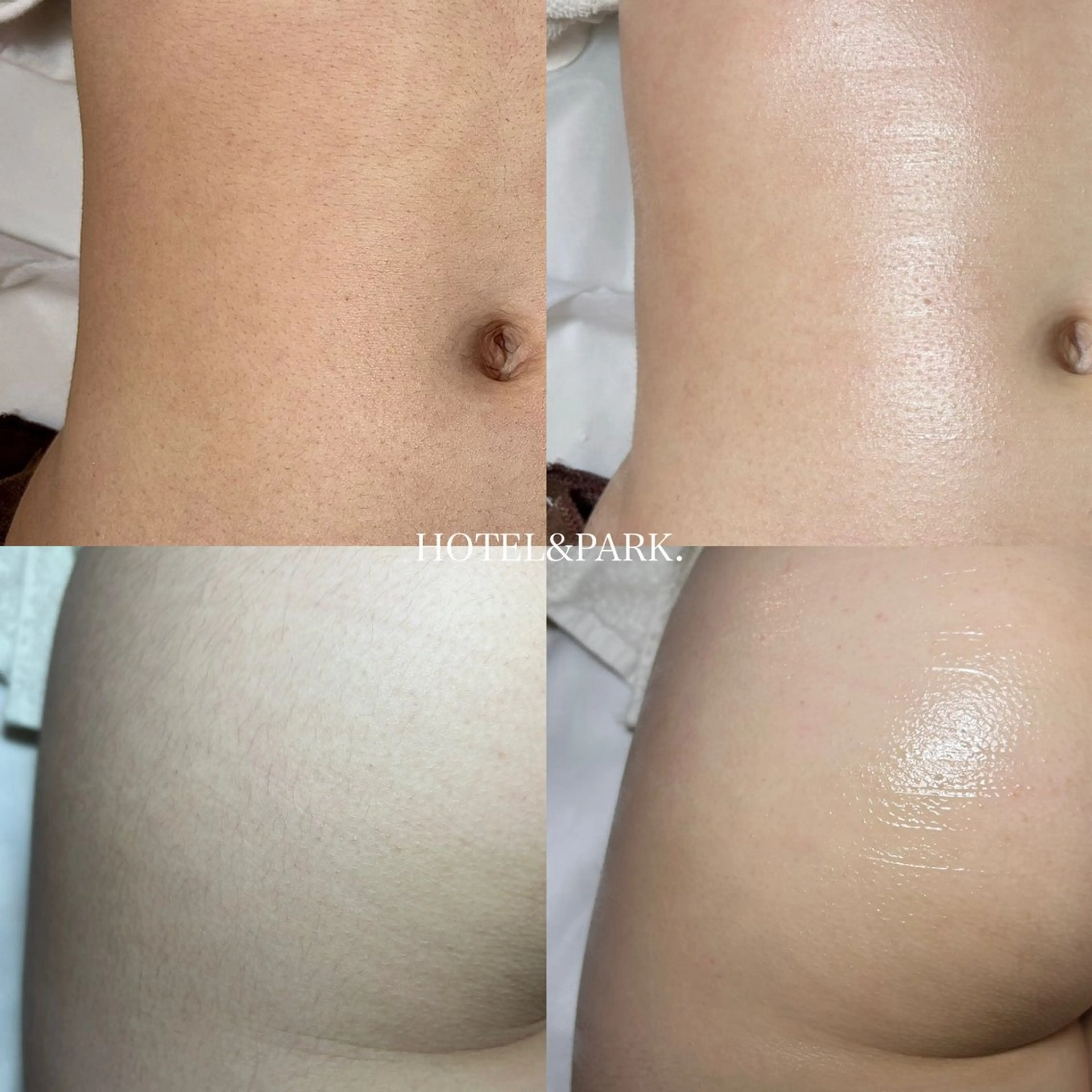 HOTEL&PARK .Moeワックス脱毛のエステ・リラクイメージ