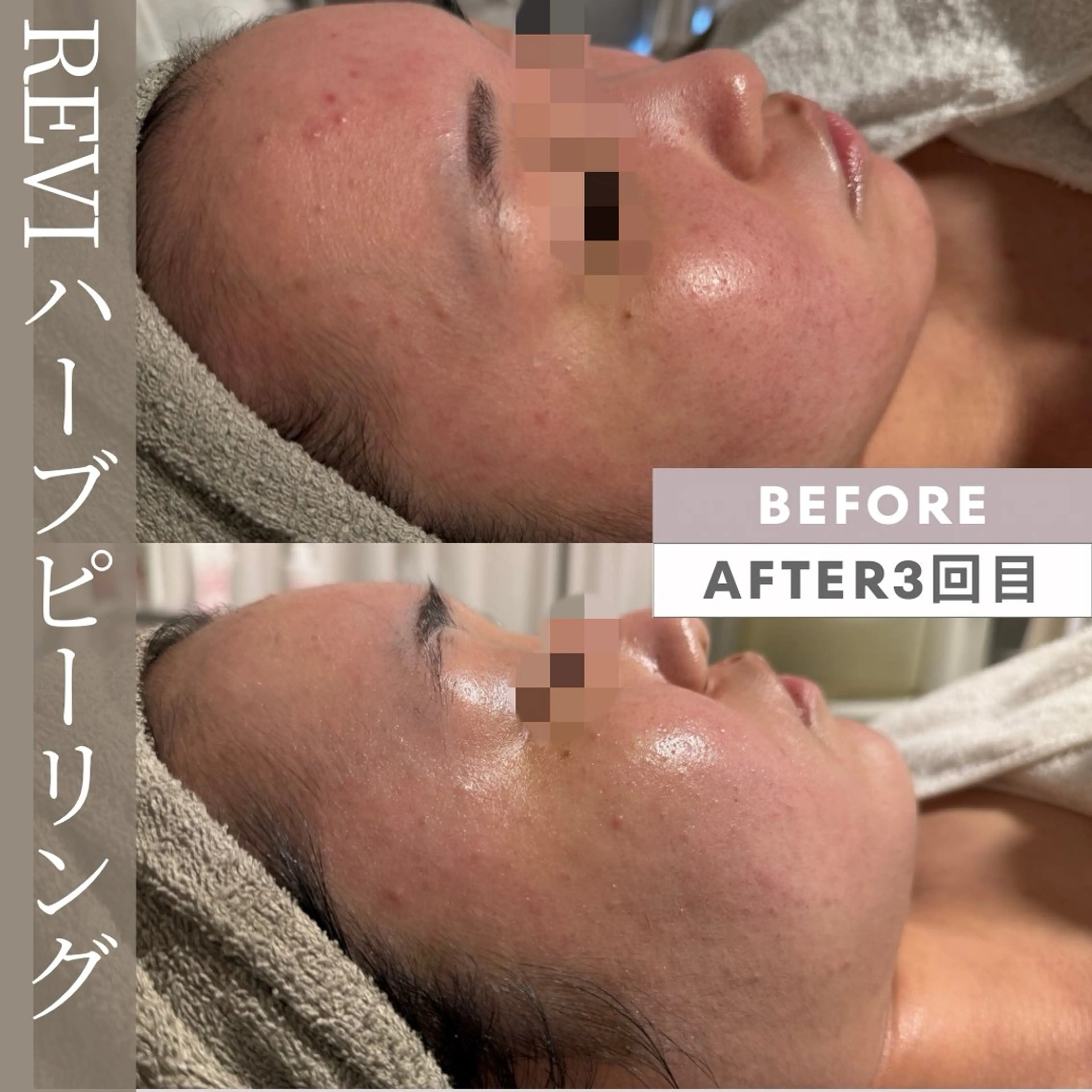 lumirise所属・lumi riseのエステ・リラクイメージ