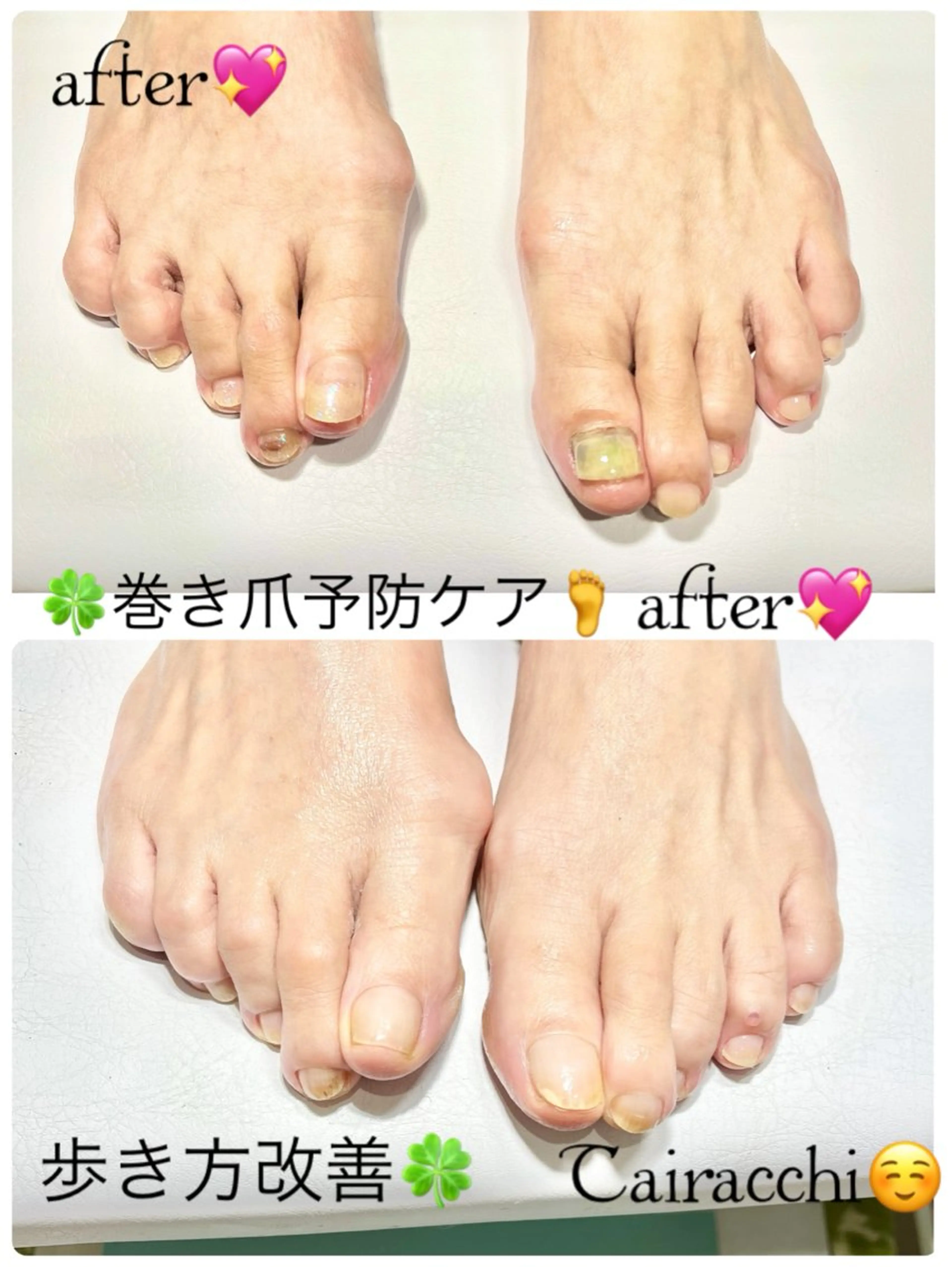 ネイル フットネイル フットネイル Tairacchi タイラッチのネイルデザイン