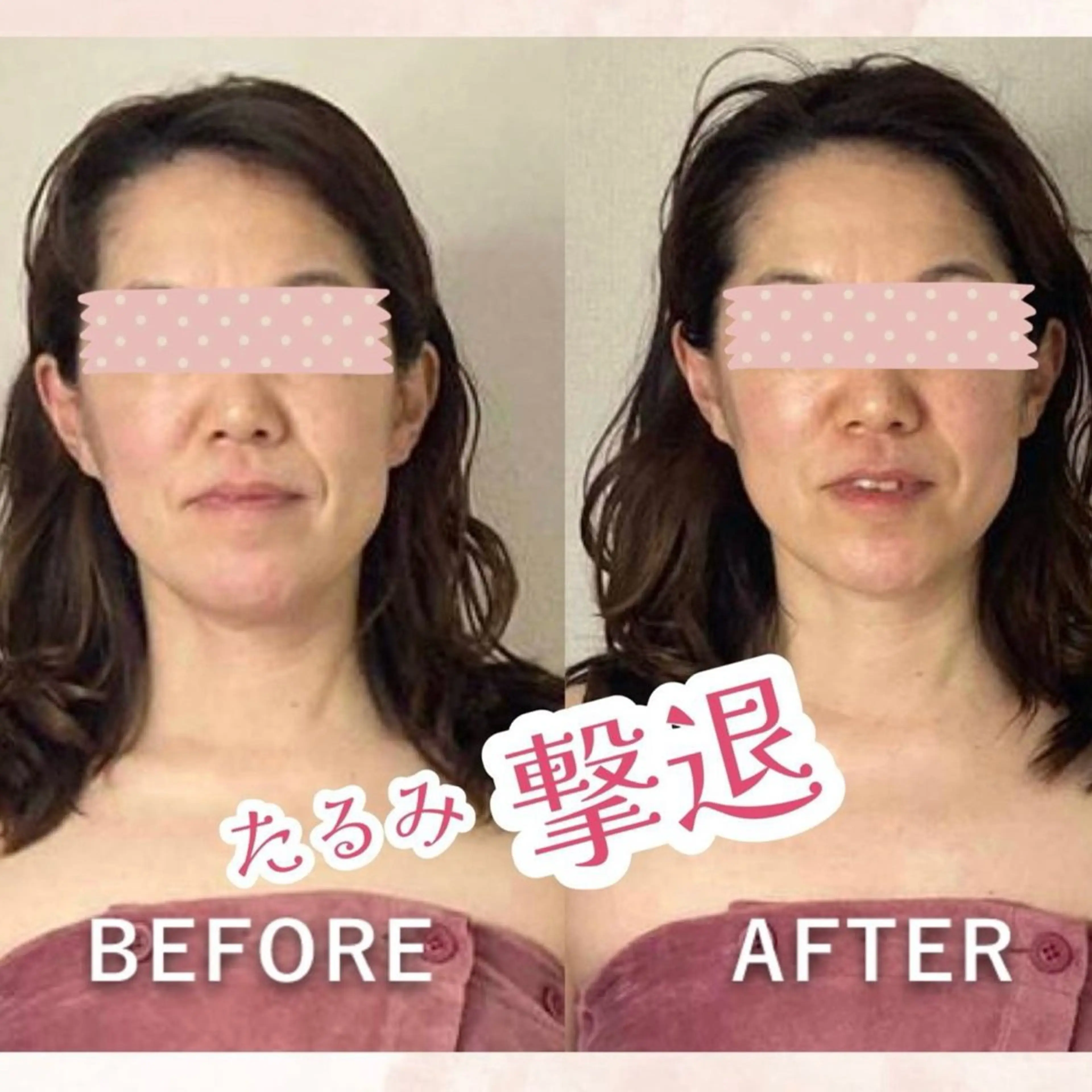 hitohana所属・毛穴/いちご鼻/小顔 /hitohanaのエステ・リラクイメージ