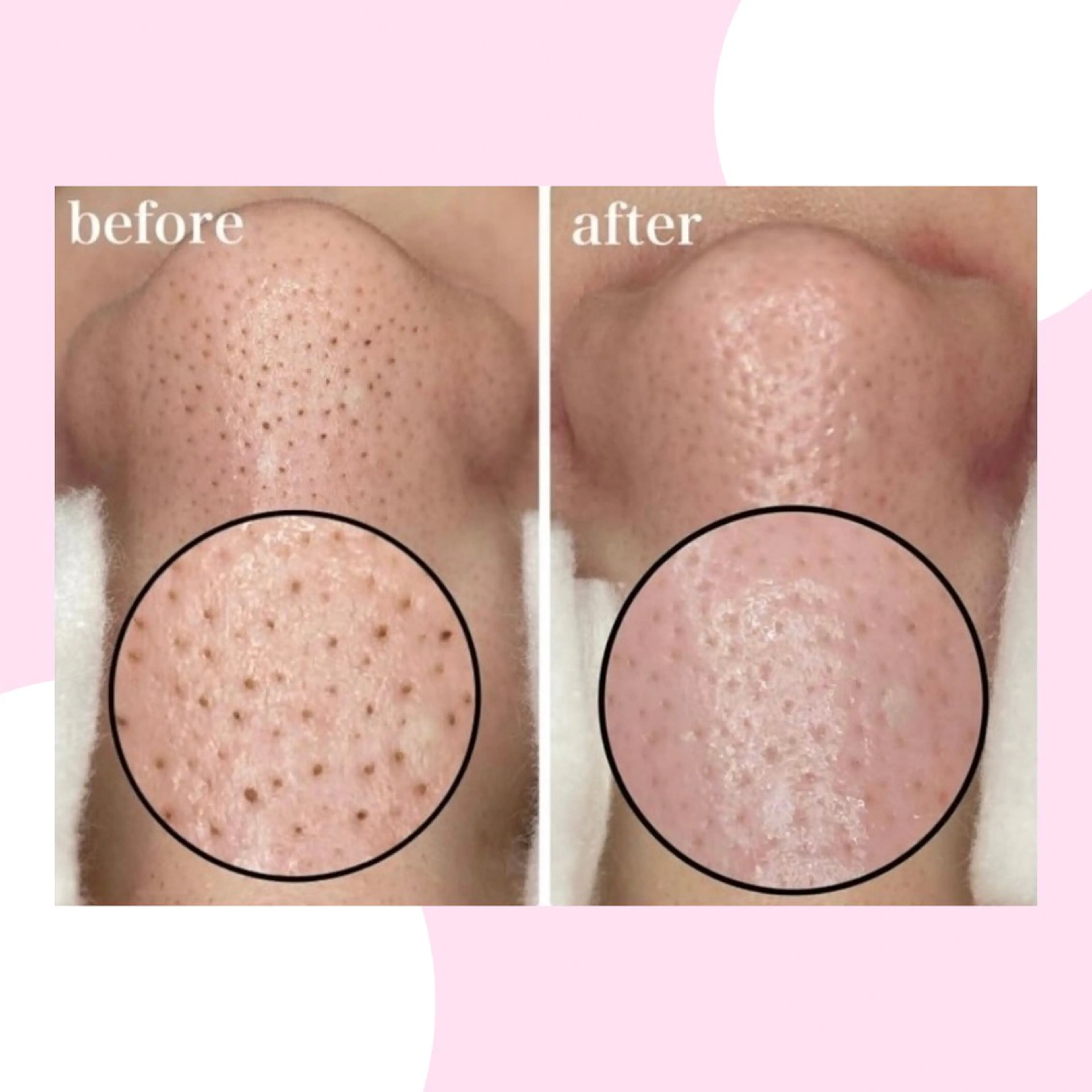 韓国肌管理Mote 新宿店のエステ・リラクイメージ