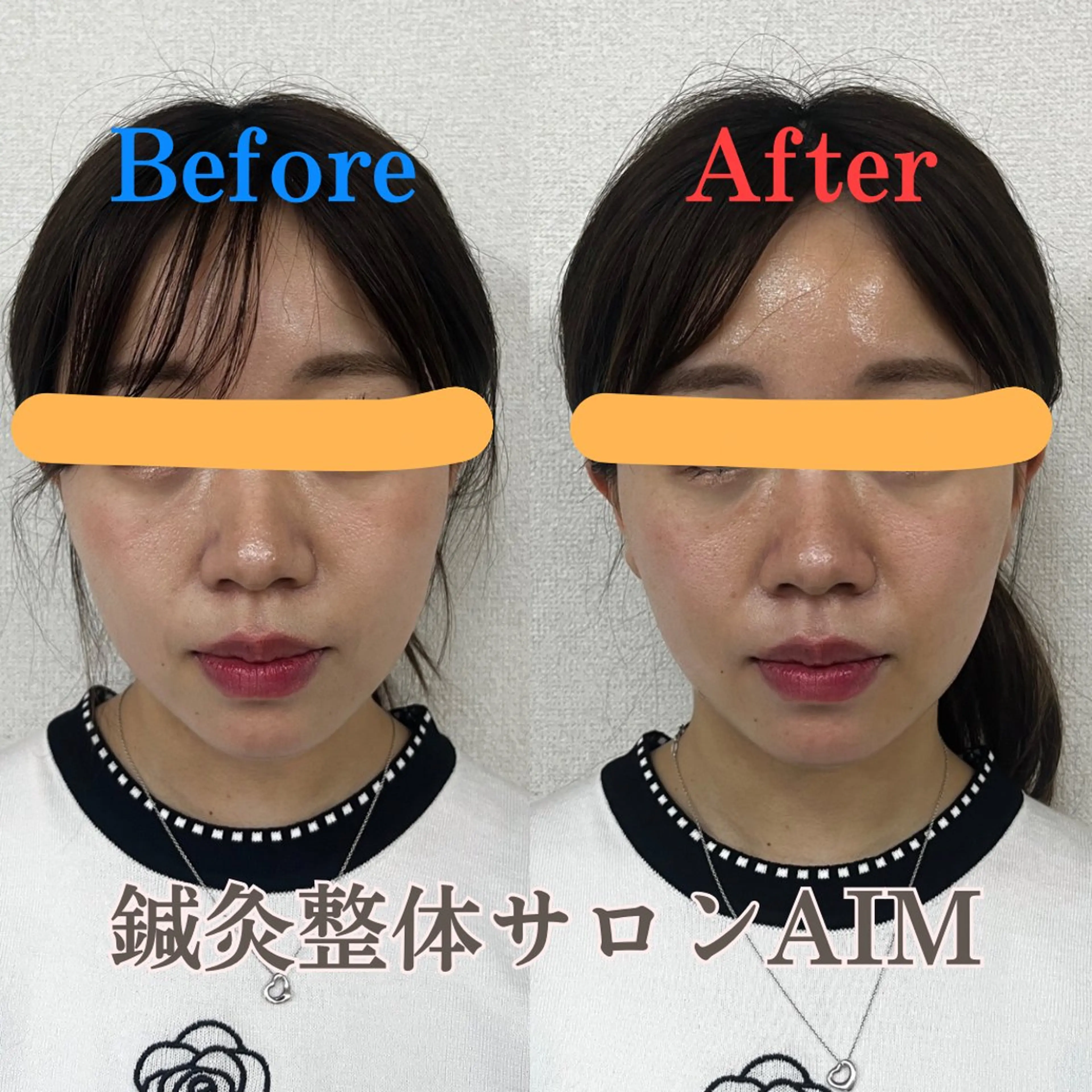 鍼灸整体サロンAIM所属・天王寺ニキビ専門 サロンAIMのエステ・リラクイメージ