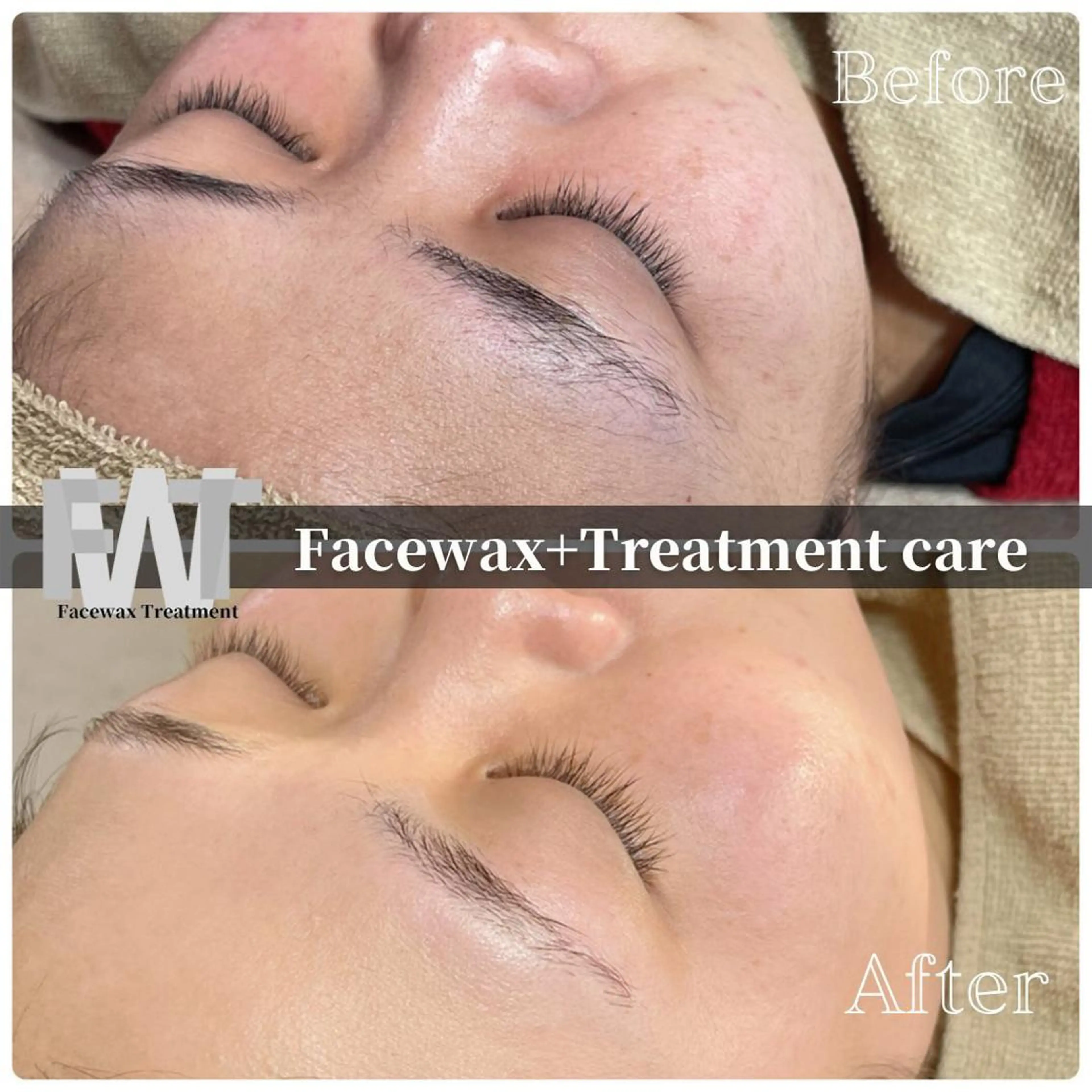 脱毛 Muqu. 毛穴サロンのエステ・リラクイメージ