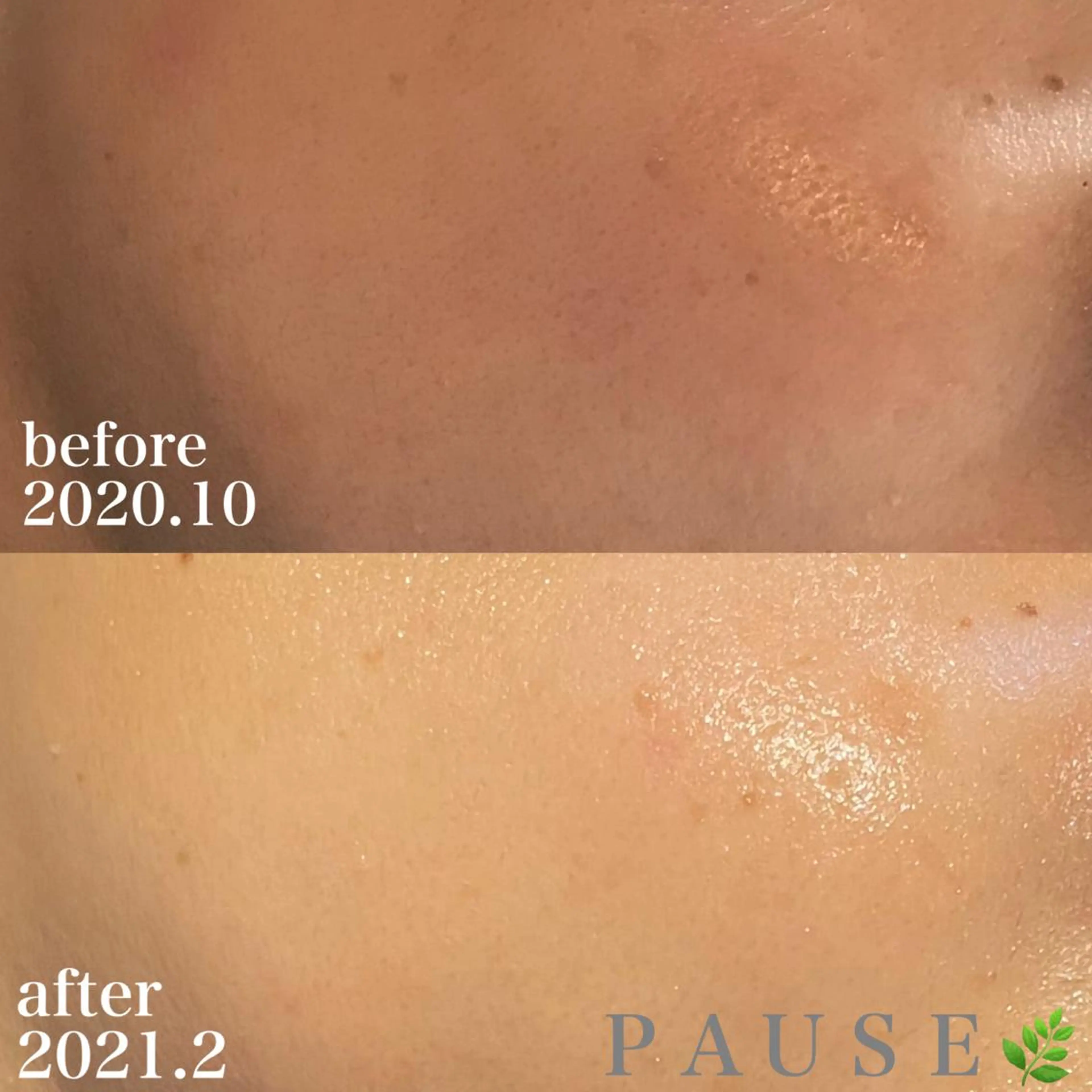 エステ リラク 浜野 恵美のエステ・リラクイメージ