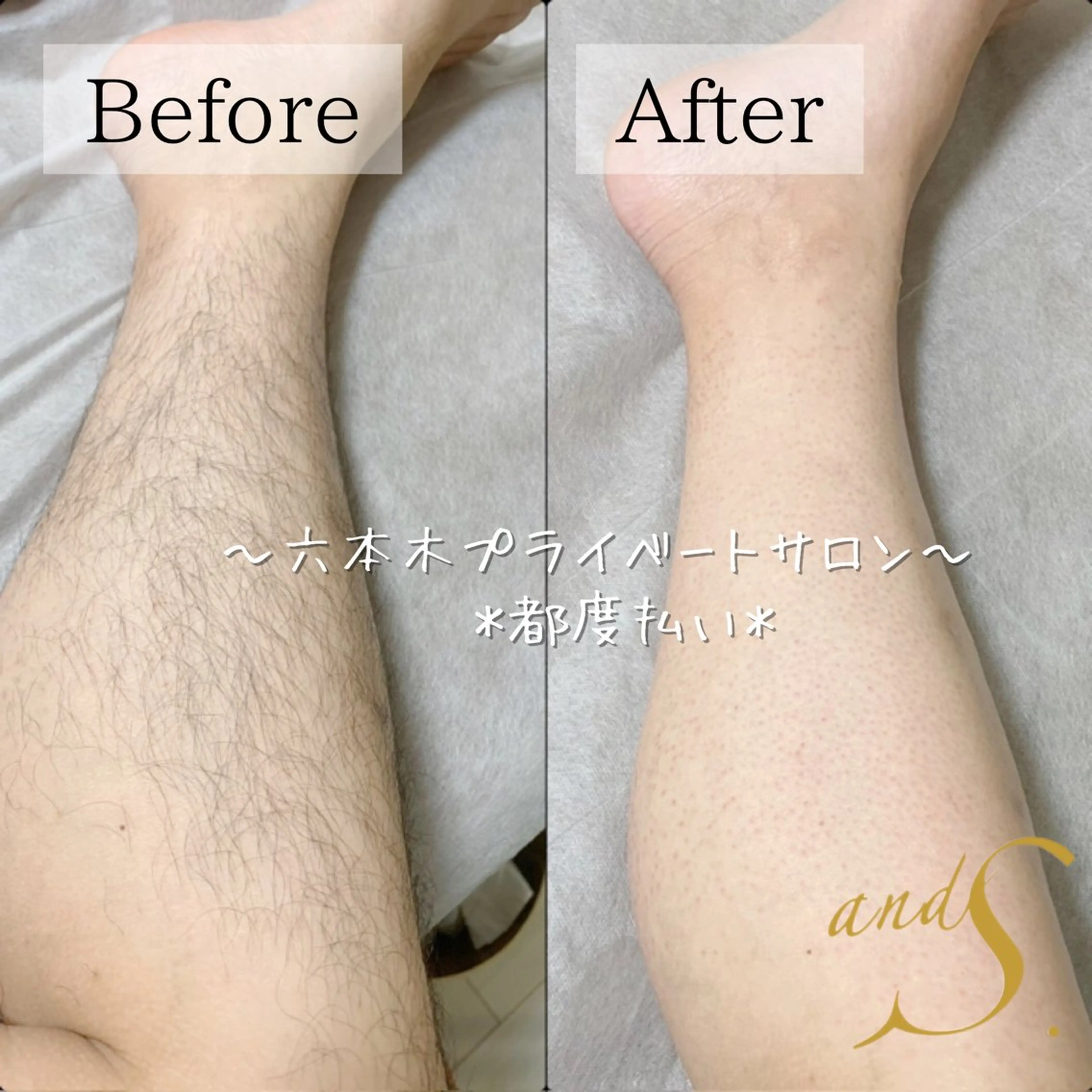 メンズ 脱毛 🌸🧡六本木 脱毛しずか🧡🫧の眉毛・アイブロウイメージ