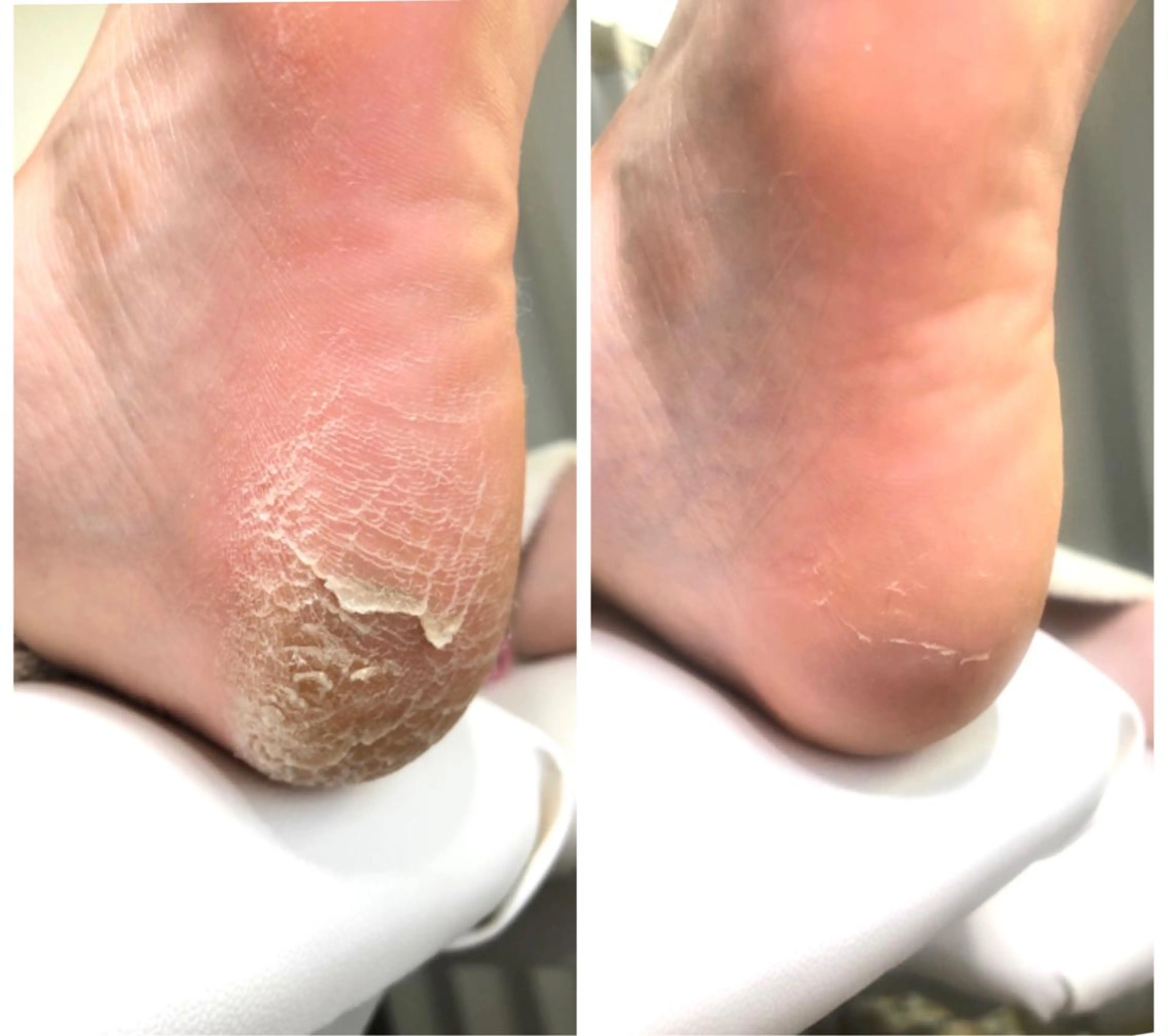 ⭐️遠藤 夏純⭐️のエステ・リラクイメージ