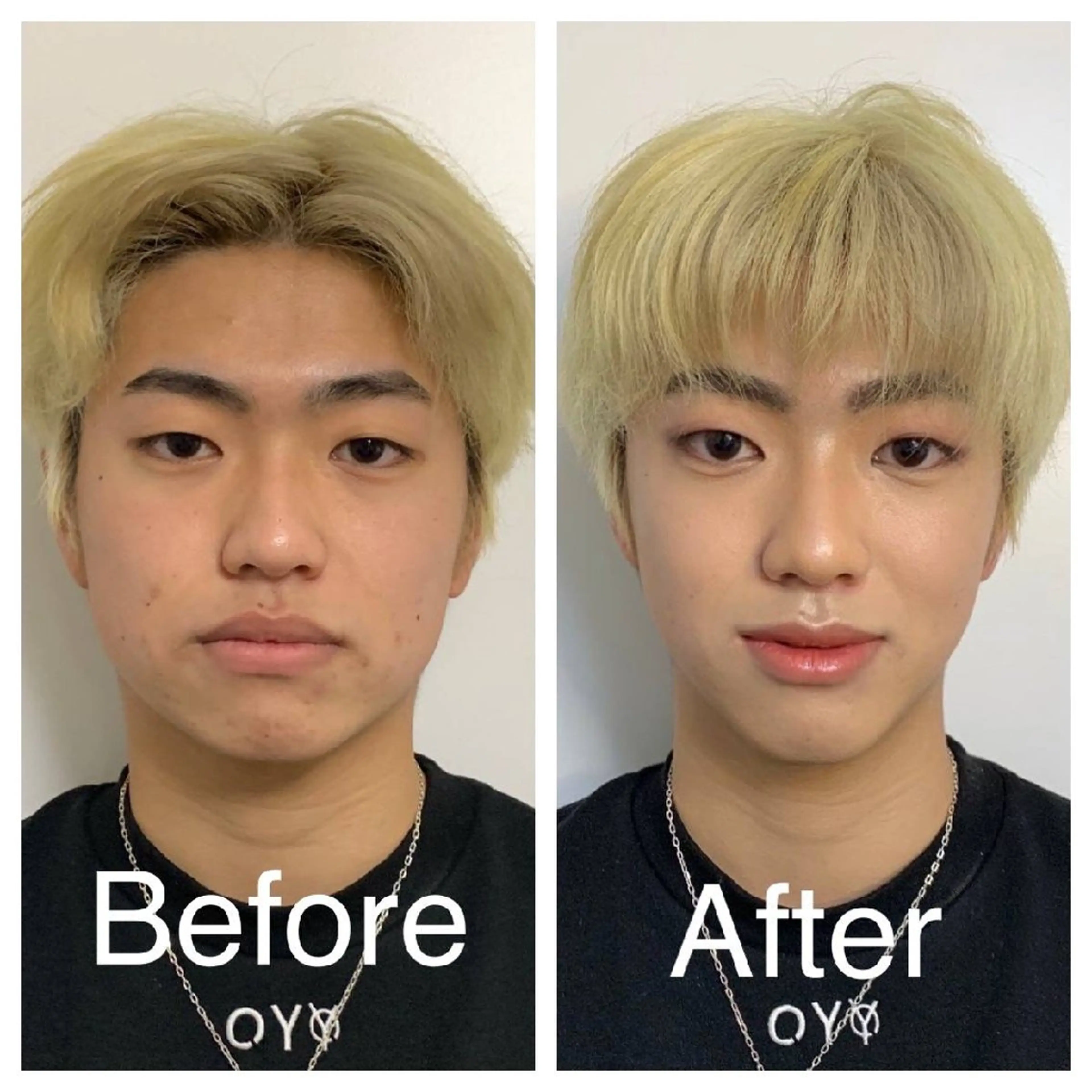 メンズ La Luna所属・医療提携サロン新宿 La Lunaのエステ・リラクイメージ