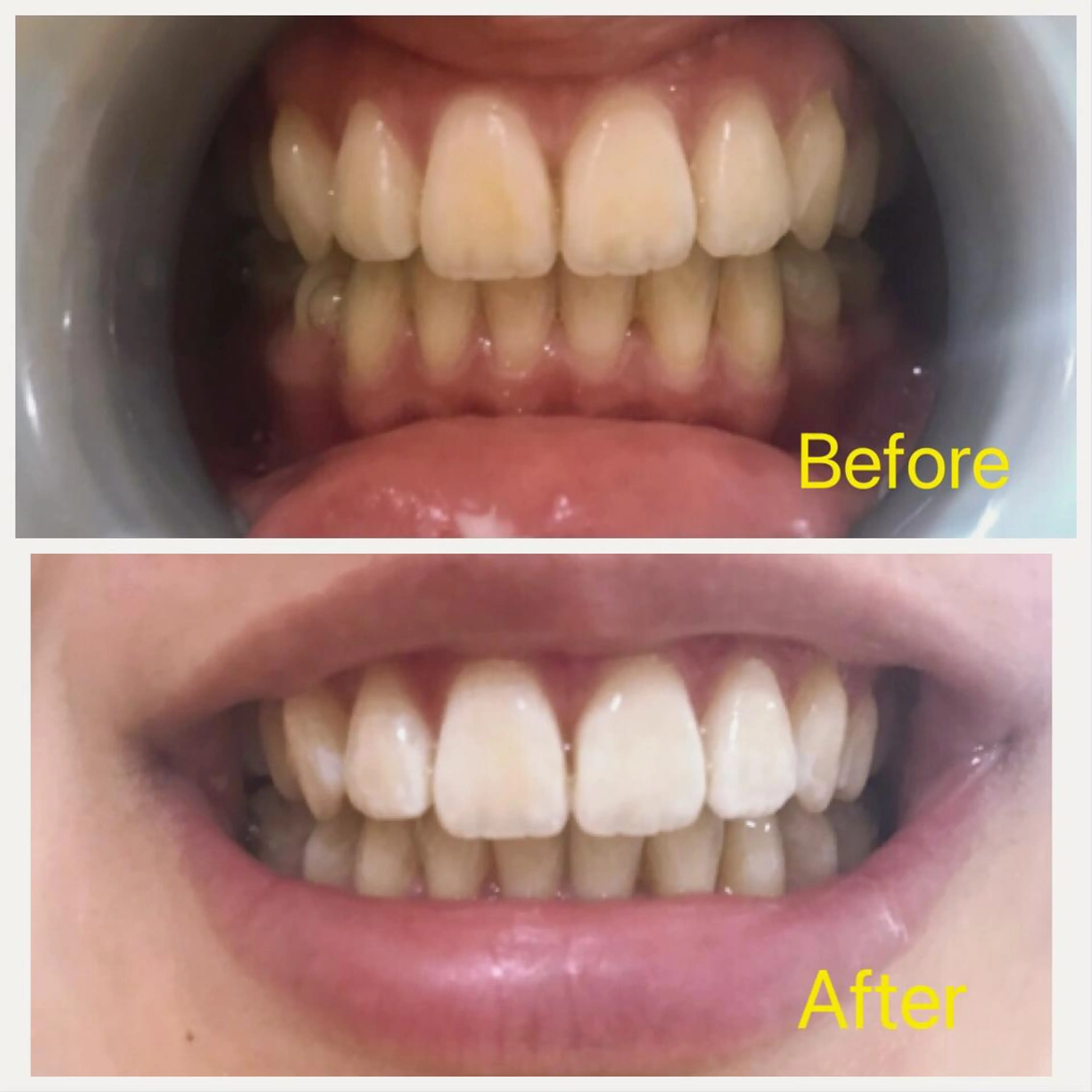 Ｍ渋谷 ホワイトニングのエステ・リラクイメージ