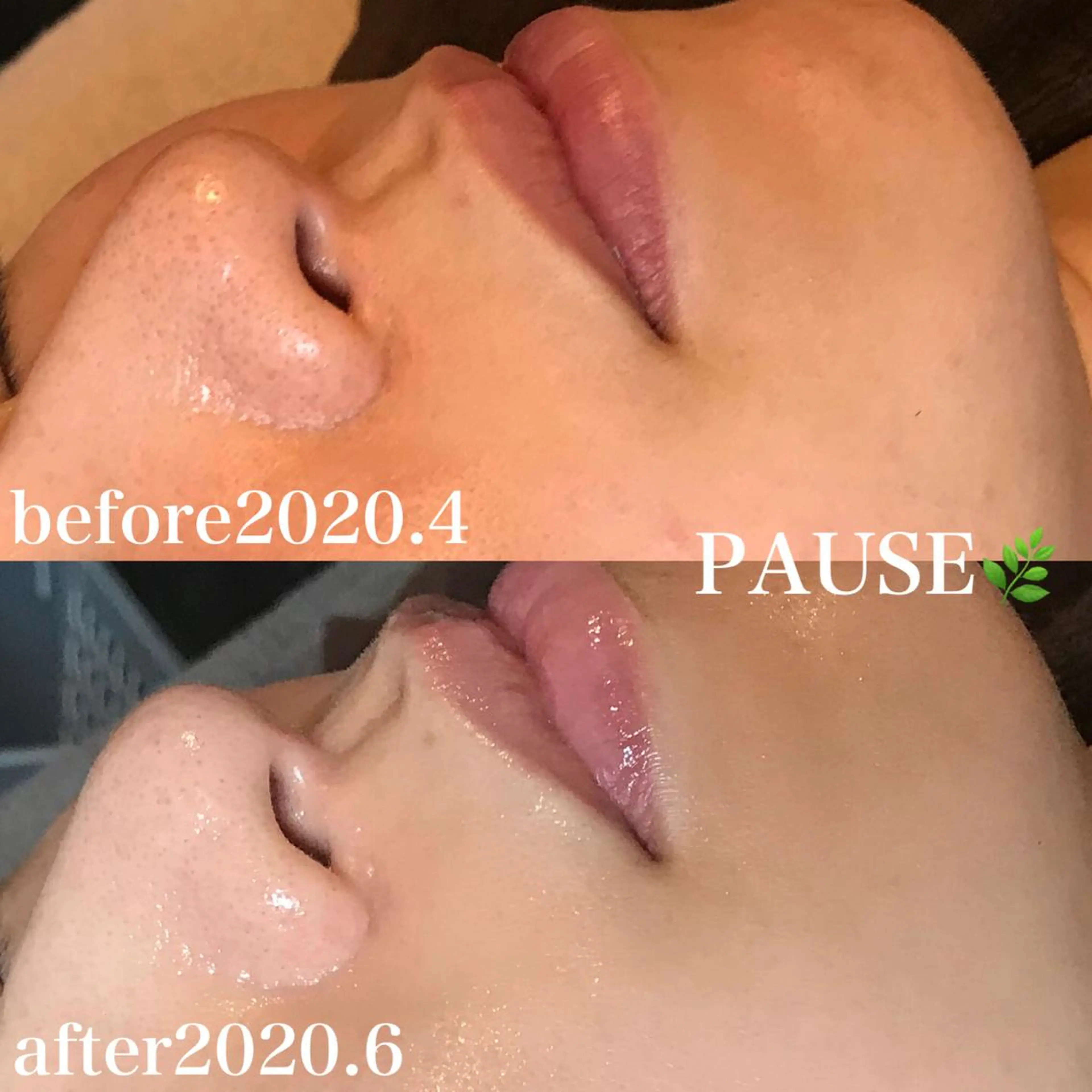 エステ 浜野 恵美のエステ・リラクイメージ