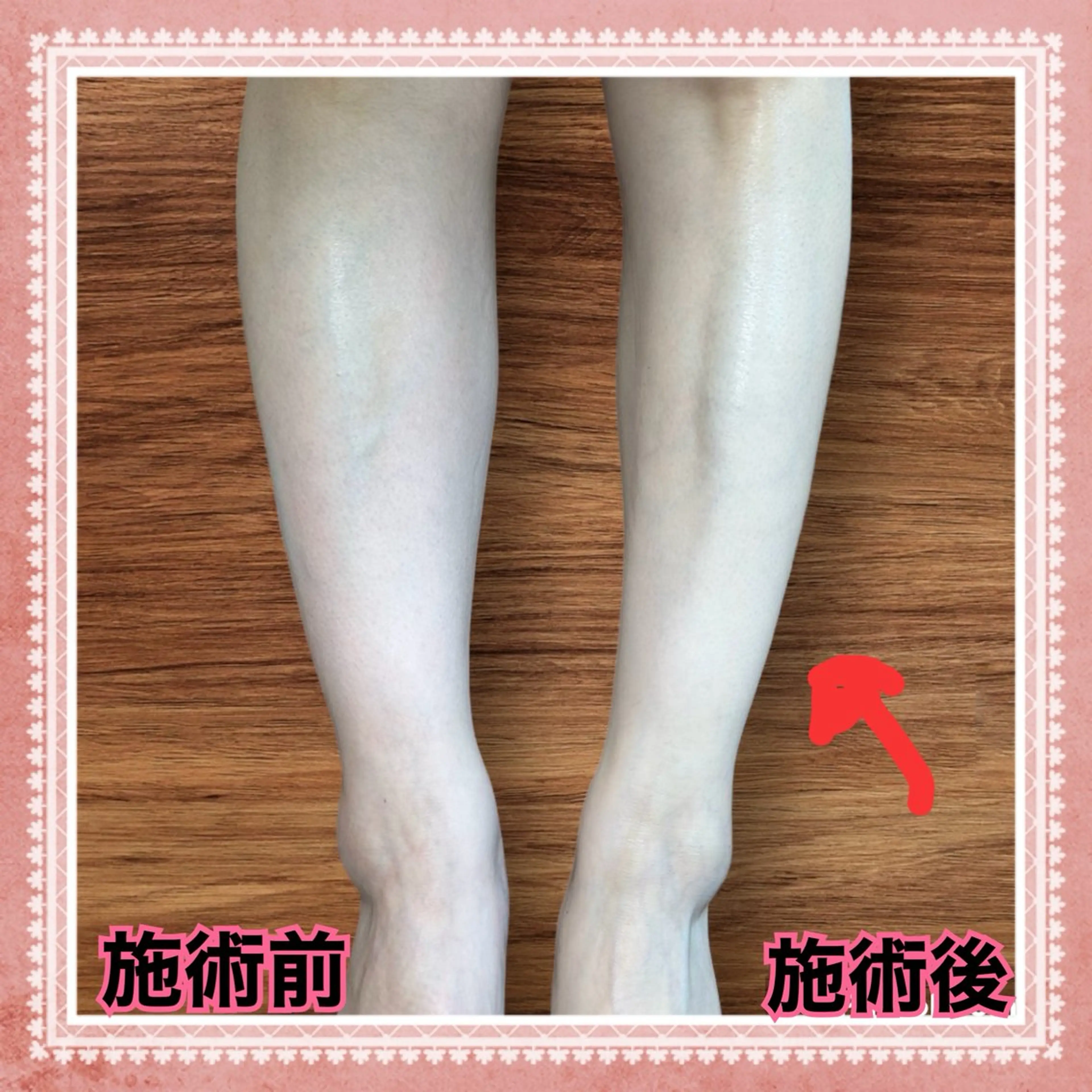 下半身集中【重だるふくらはぎ、足裏疲れ&足痩せ】下半身スッキリコース初回体験60分の写真