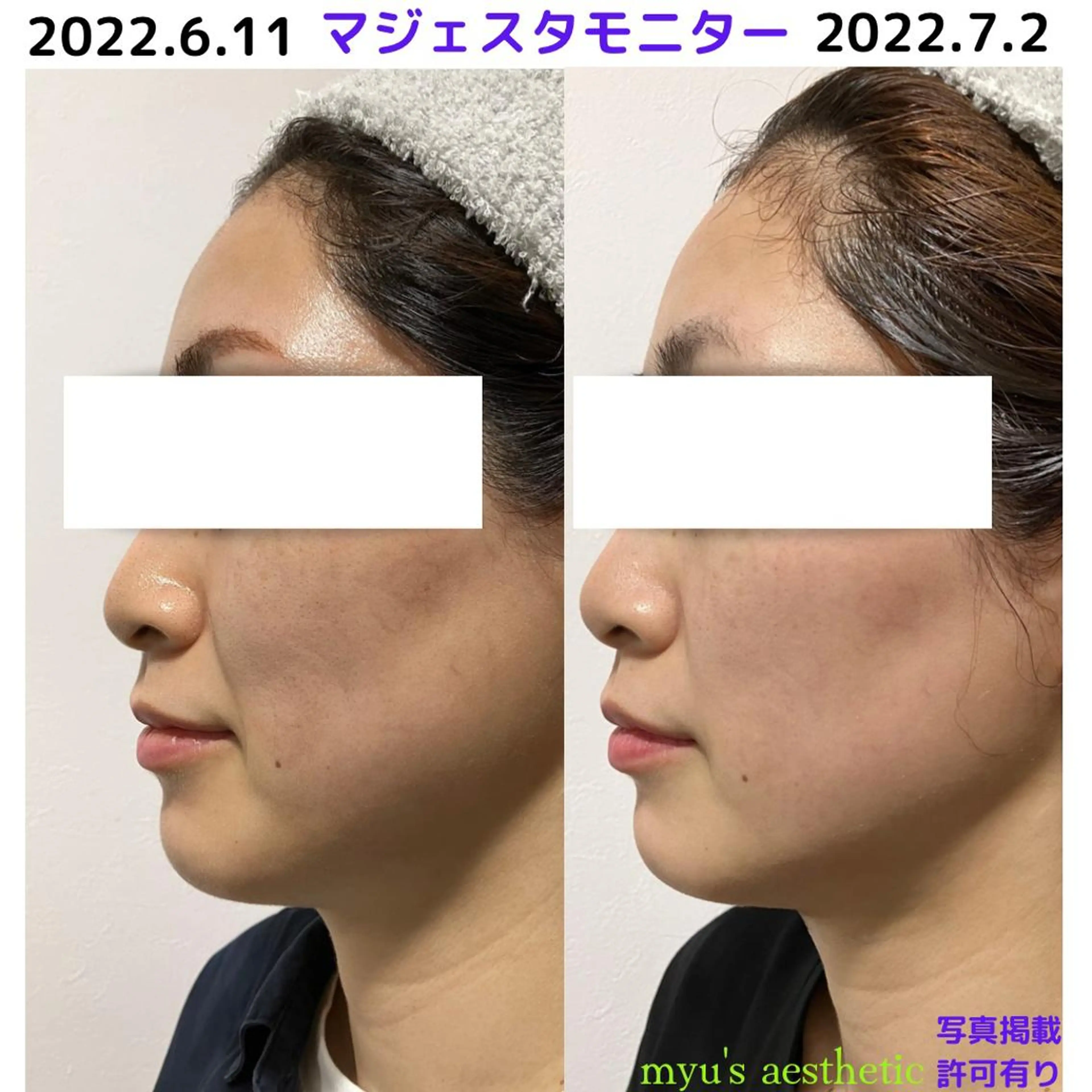 ミューズエステ 谷口美結のエステ・リラクイメージ