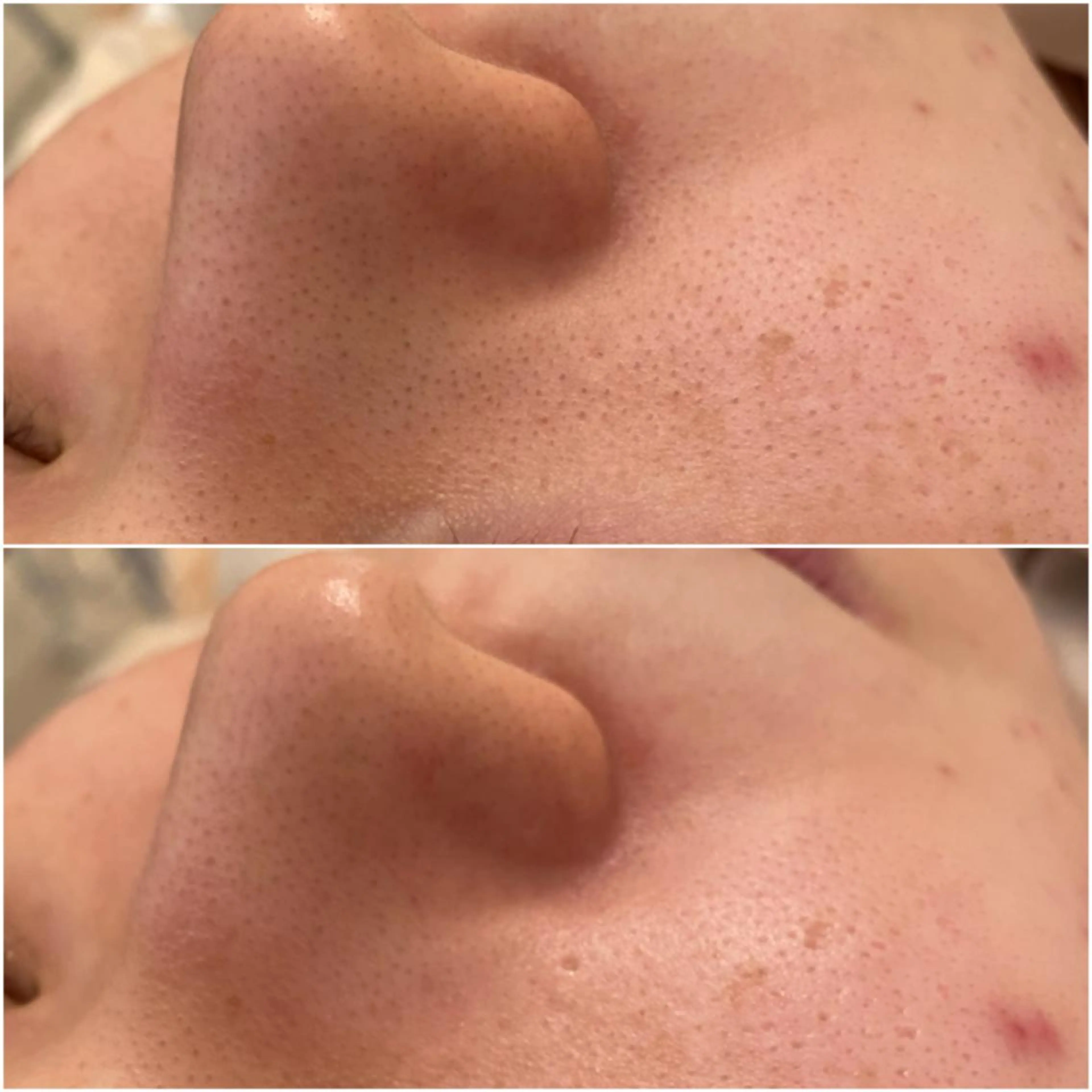 ララ/ハーブ メゾンリュバンのエステ・リラクイメージ