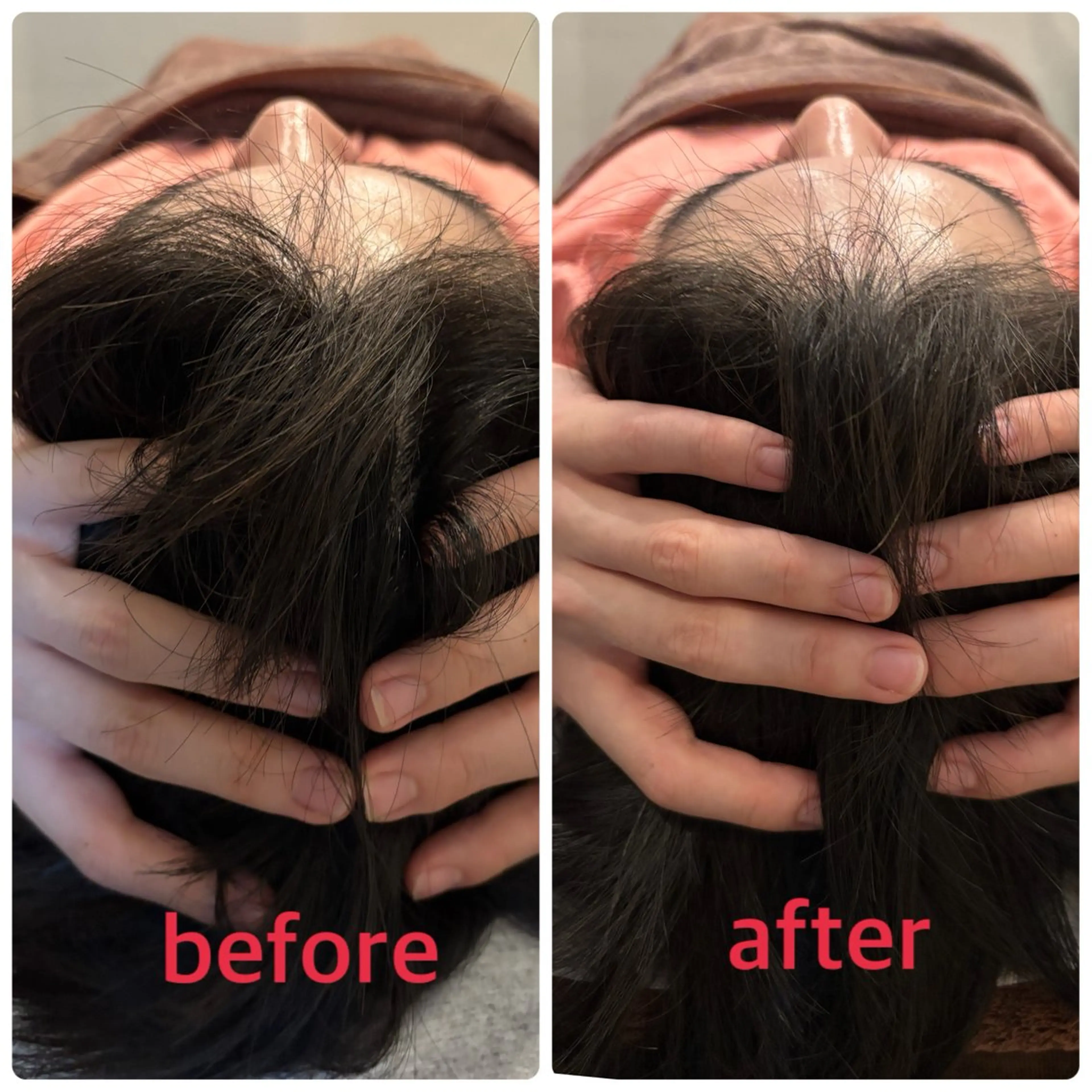 エステ リラク 小林整骨院本町 美容鍼roomのエステ・リラクイメージ