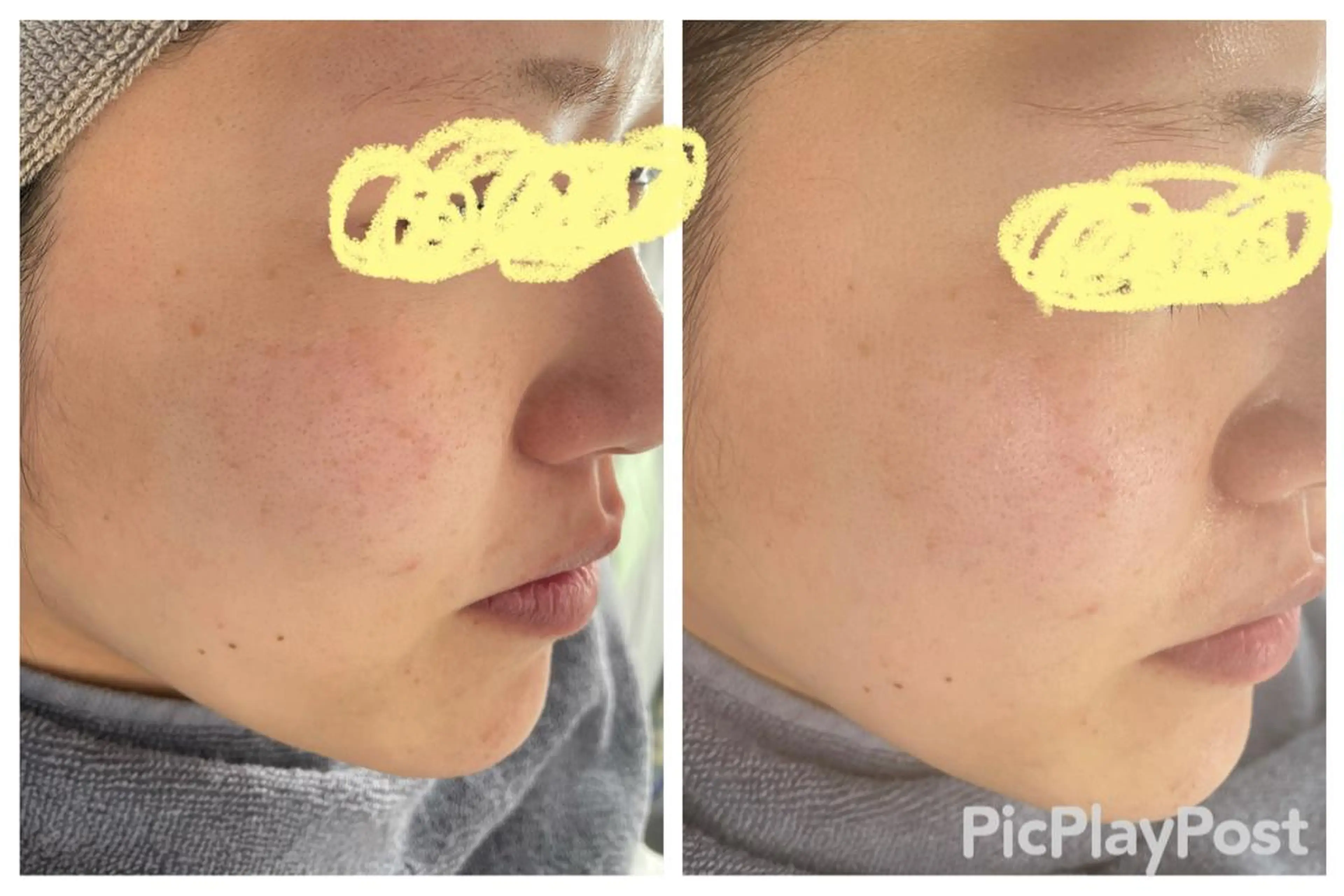 フェイシャルエステ 🌼肌改善🫧のエステ・リラクイメージ