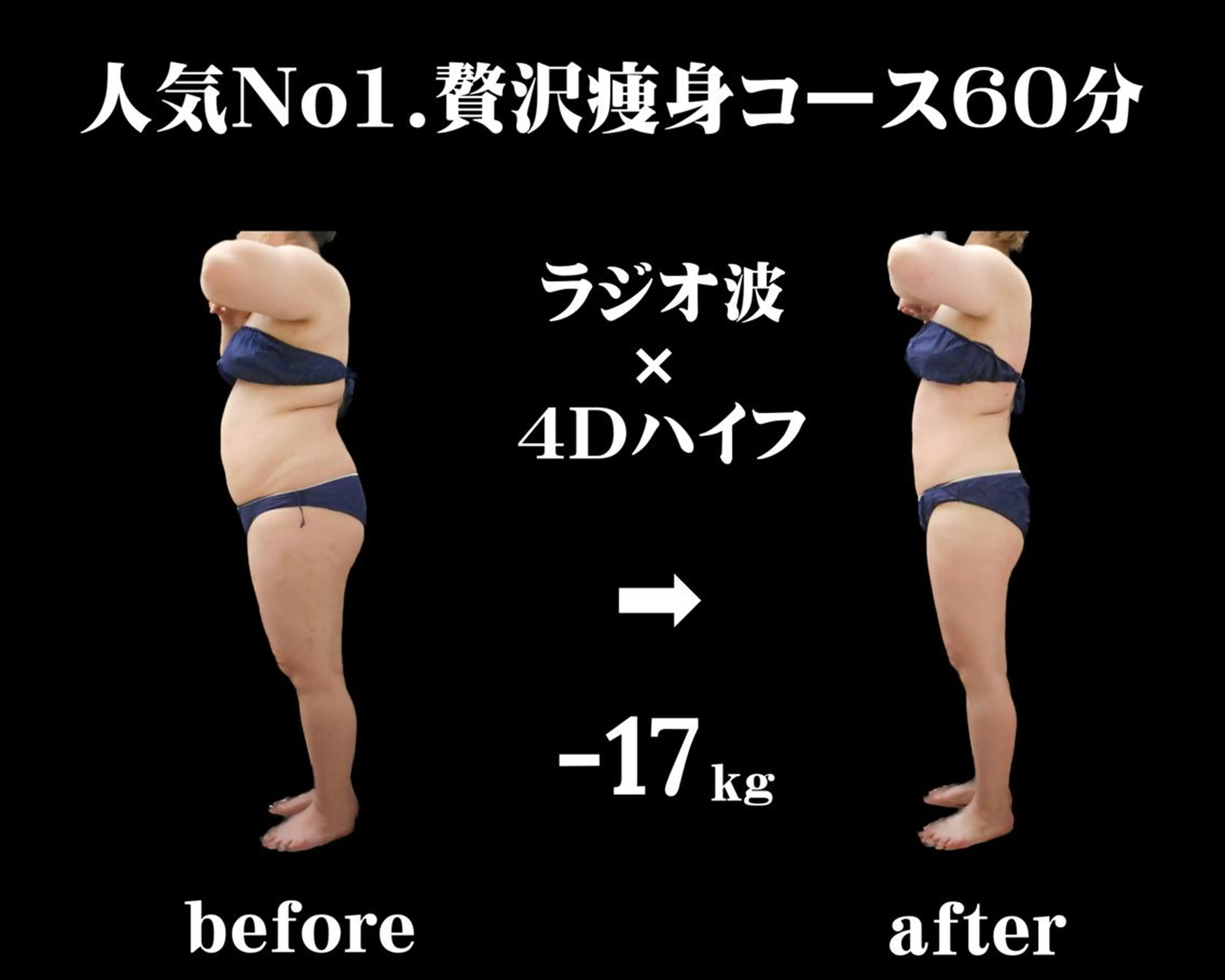 ★成功者続出サロン◎【太もも・ふくらはぎ・ヒップ】オーダーメイド痩身★下半身集中痩せ60分　2980円の写真