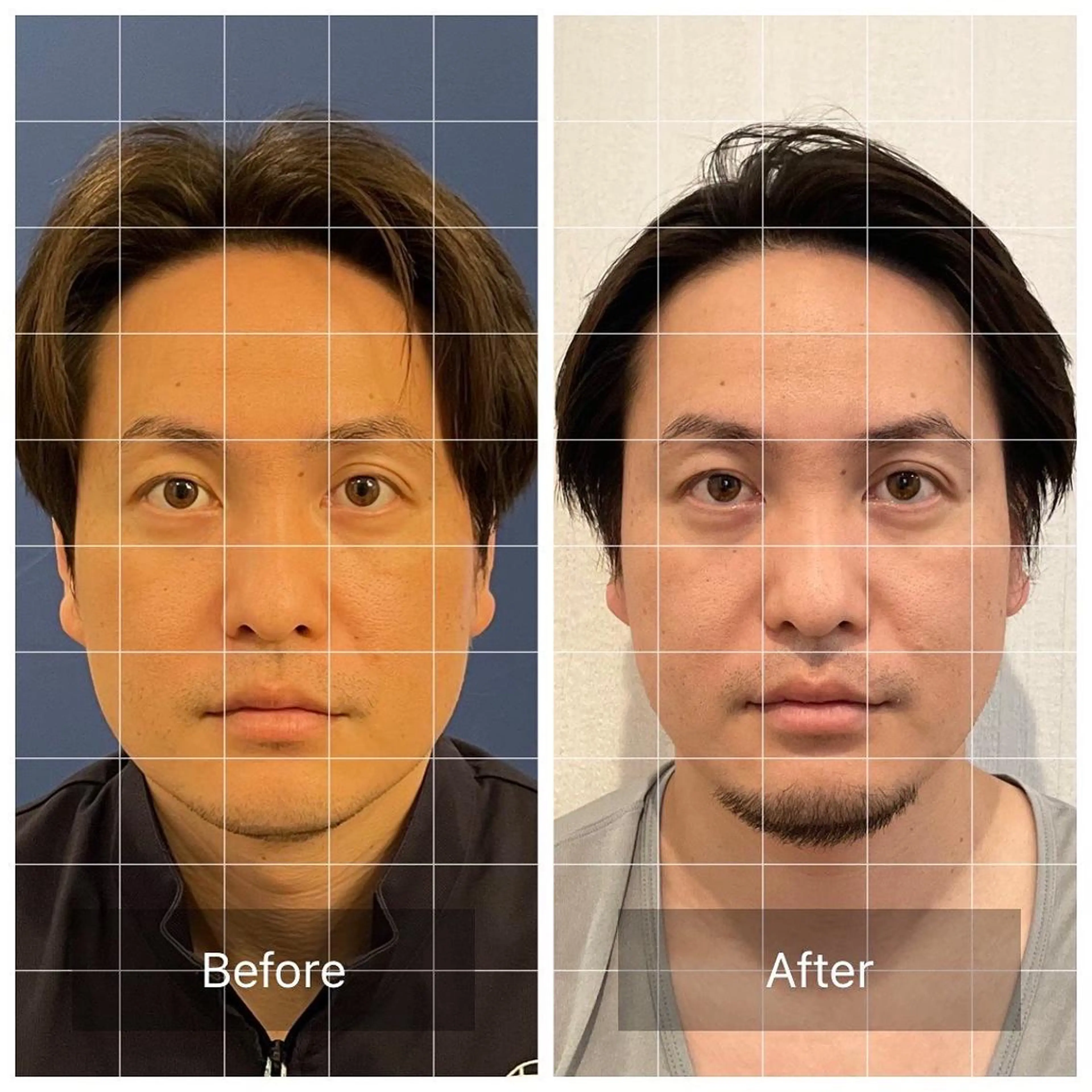 美容鍼「蒼月」 -アオツキ-のエステ・リラクイメージ