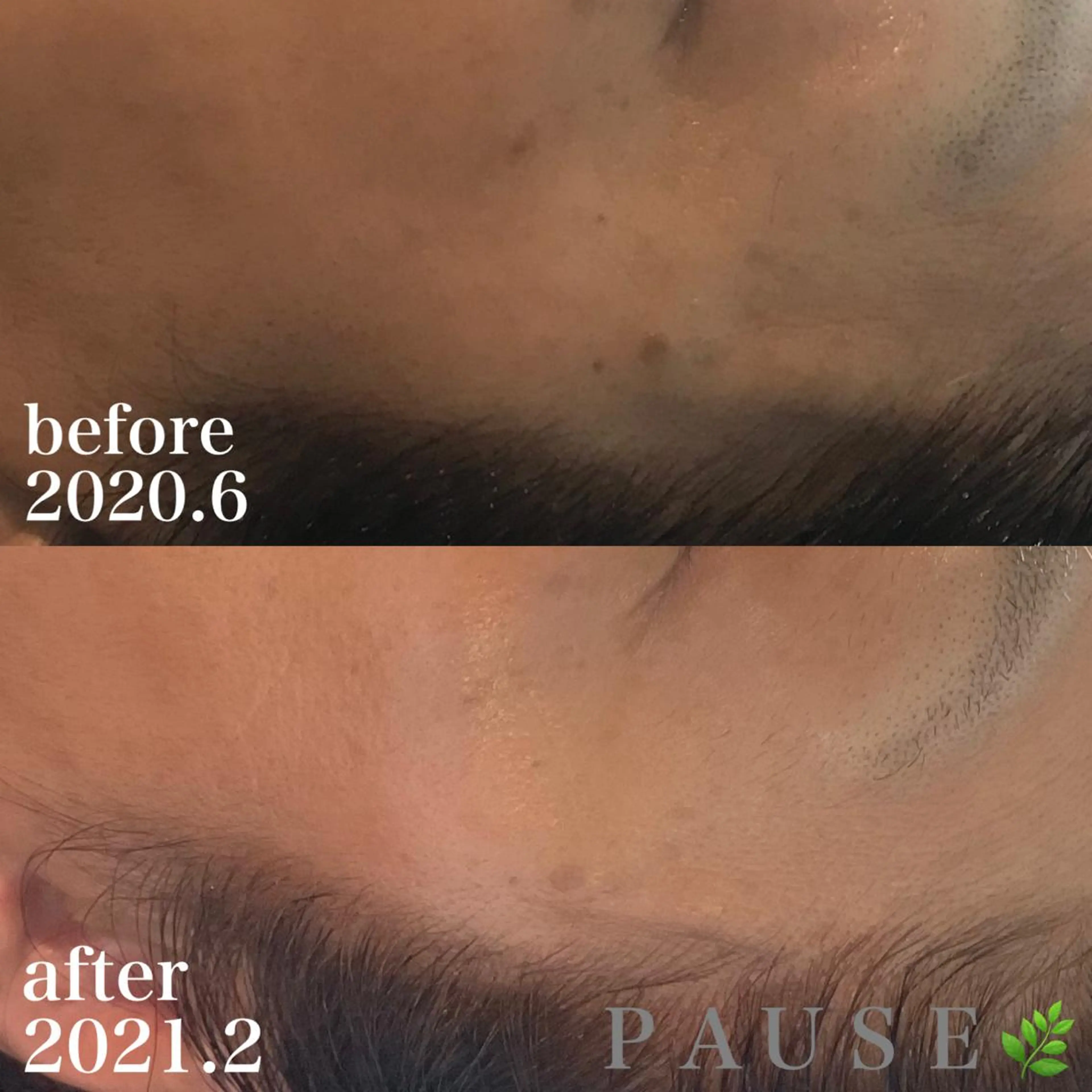 エステ 浜野 恵美のエステ・リラクイメージ