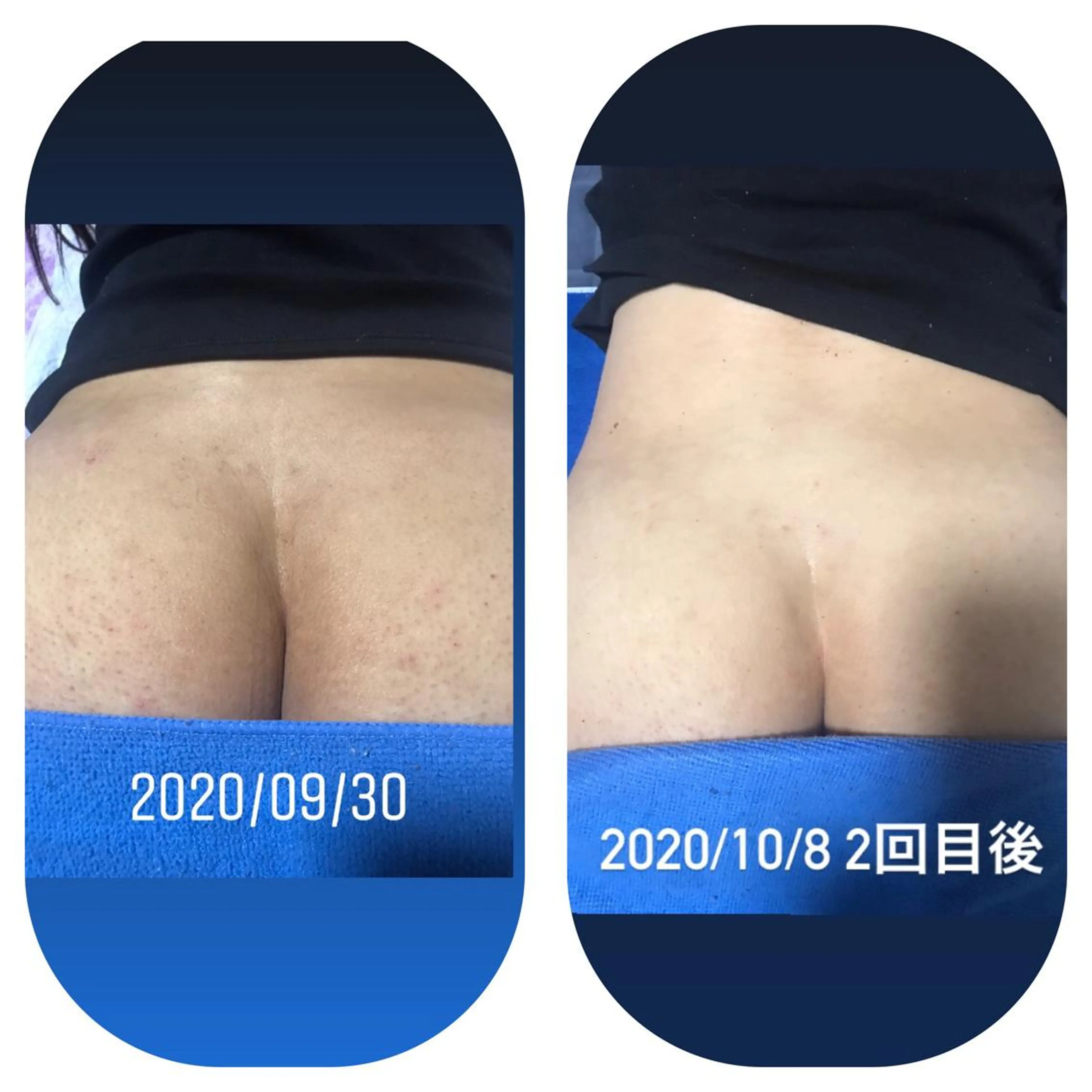 エステ リラク 【足圧】鬼👹リンパ 身体整うサロンのエステ・リラクイメージ