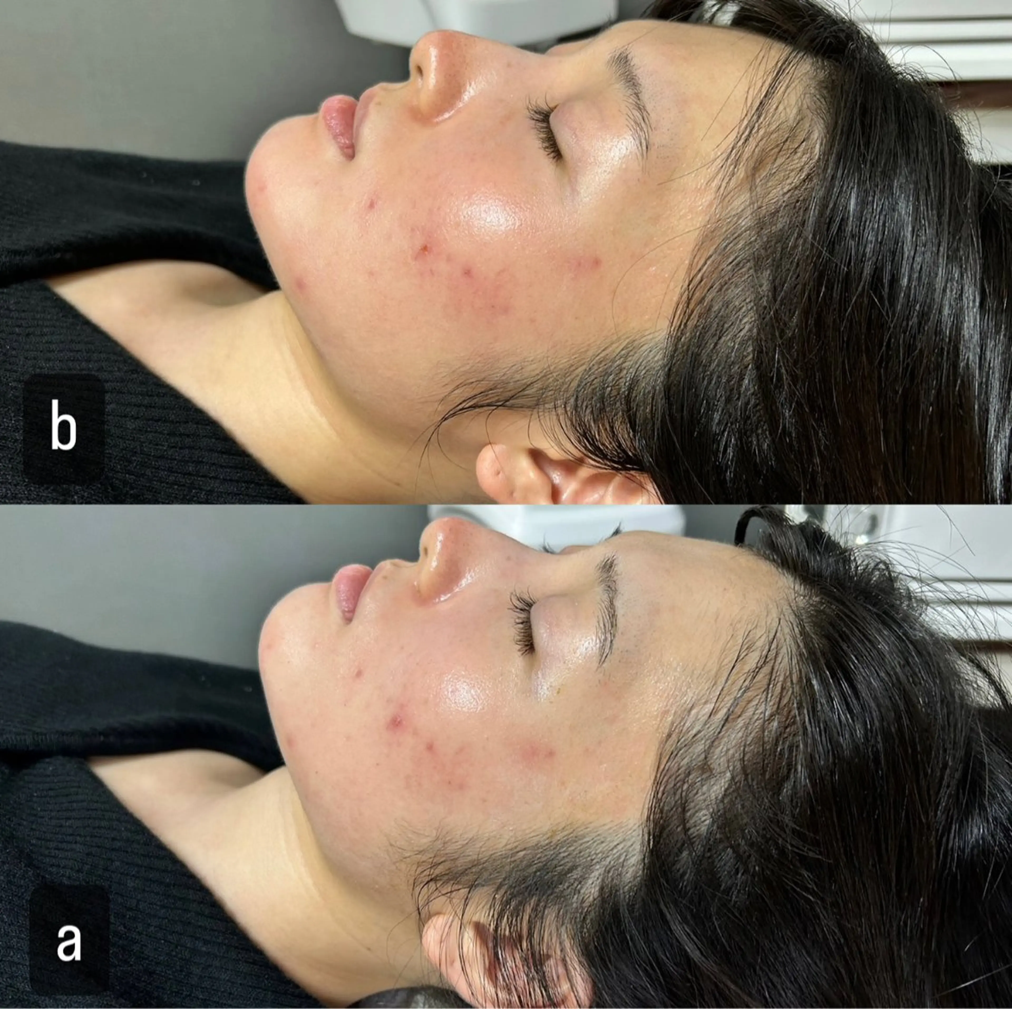 217 ホワイトニングルームのエステ・リラクイメージ