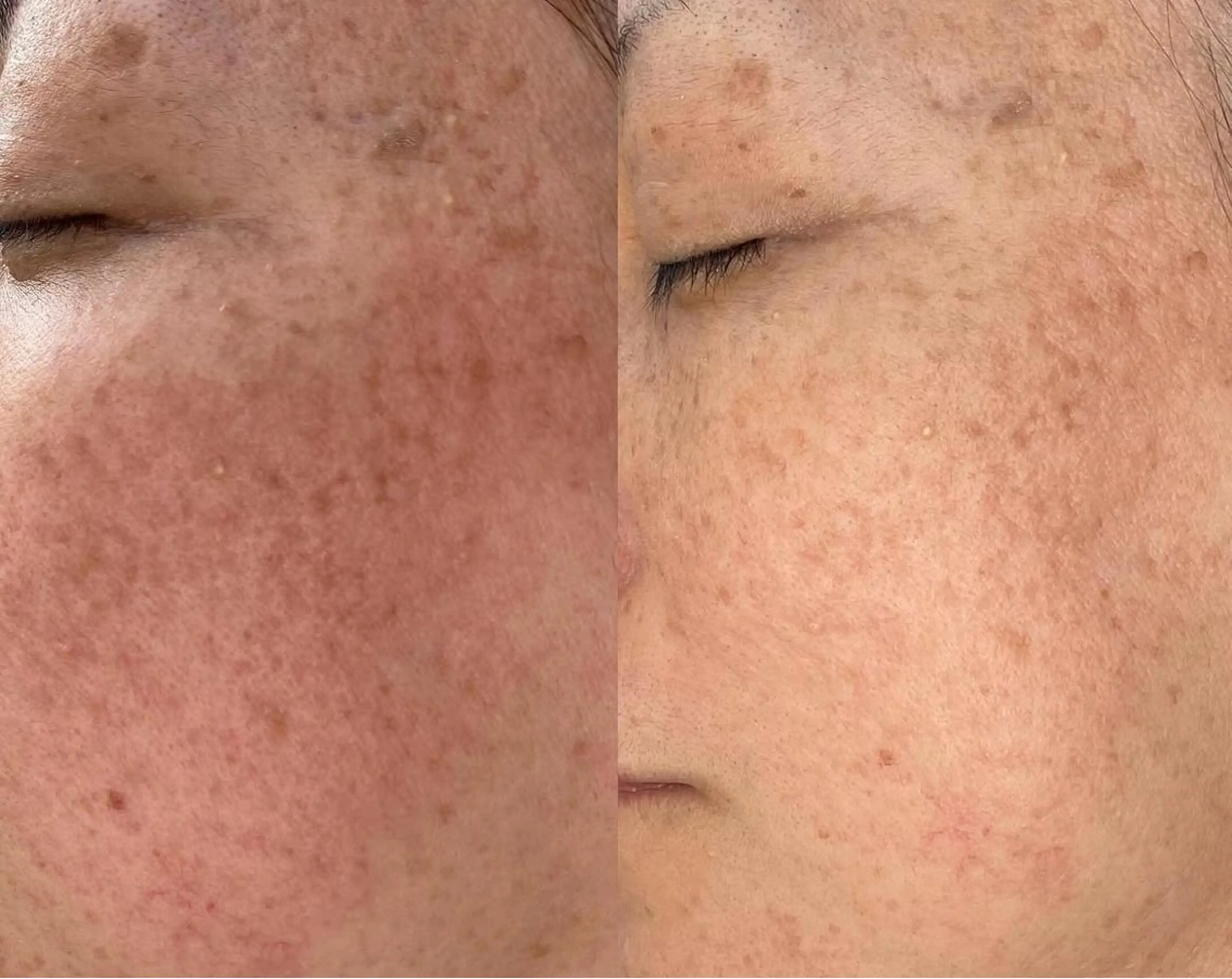 毛穴・頭皮 専門店💪のその他イメージ