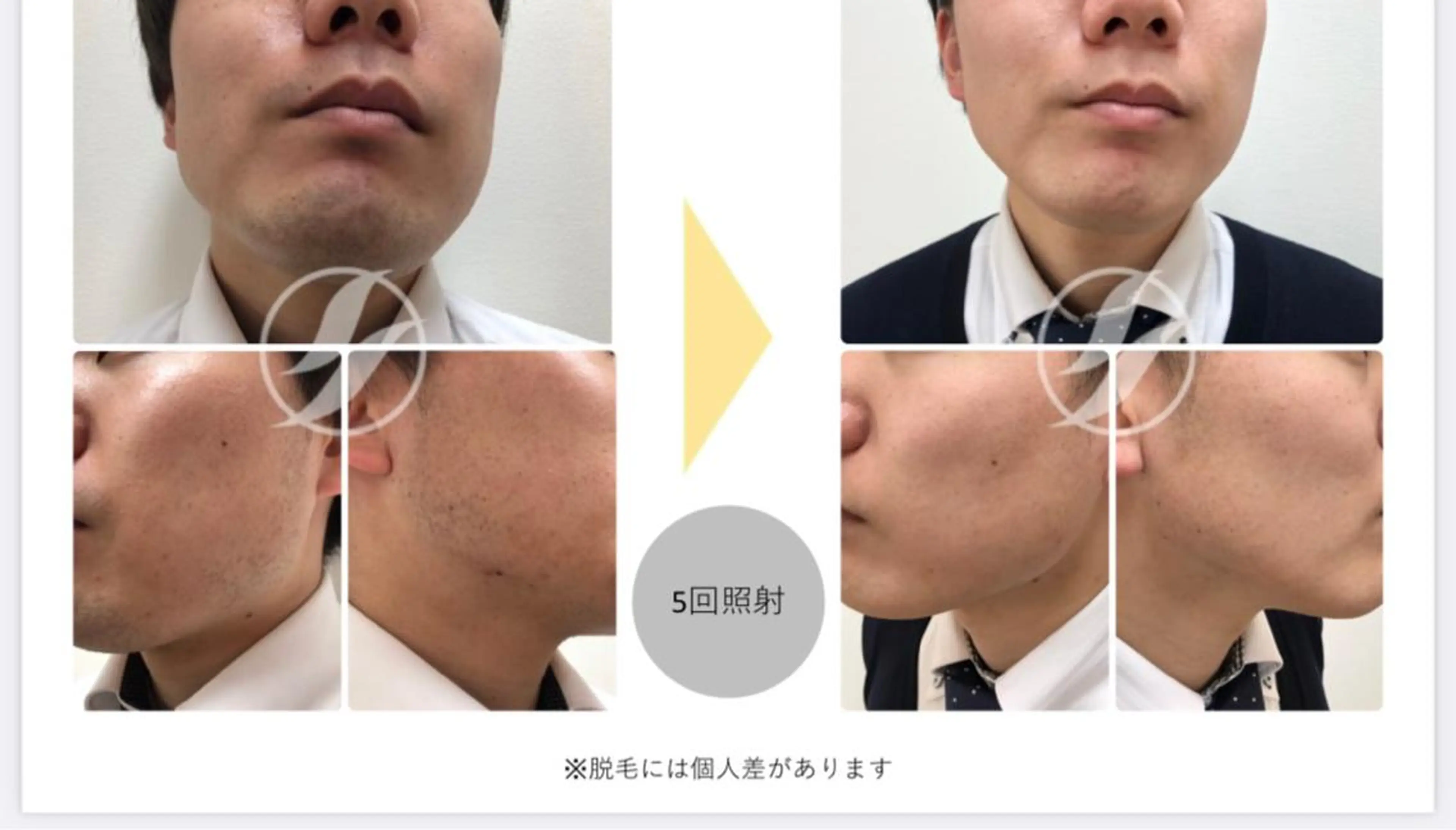 メンズ esperanza エスペランサのその他イメージ