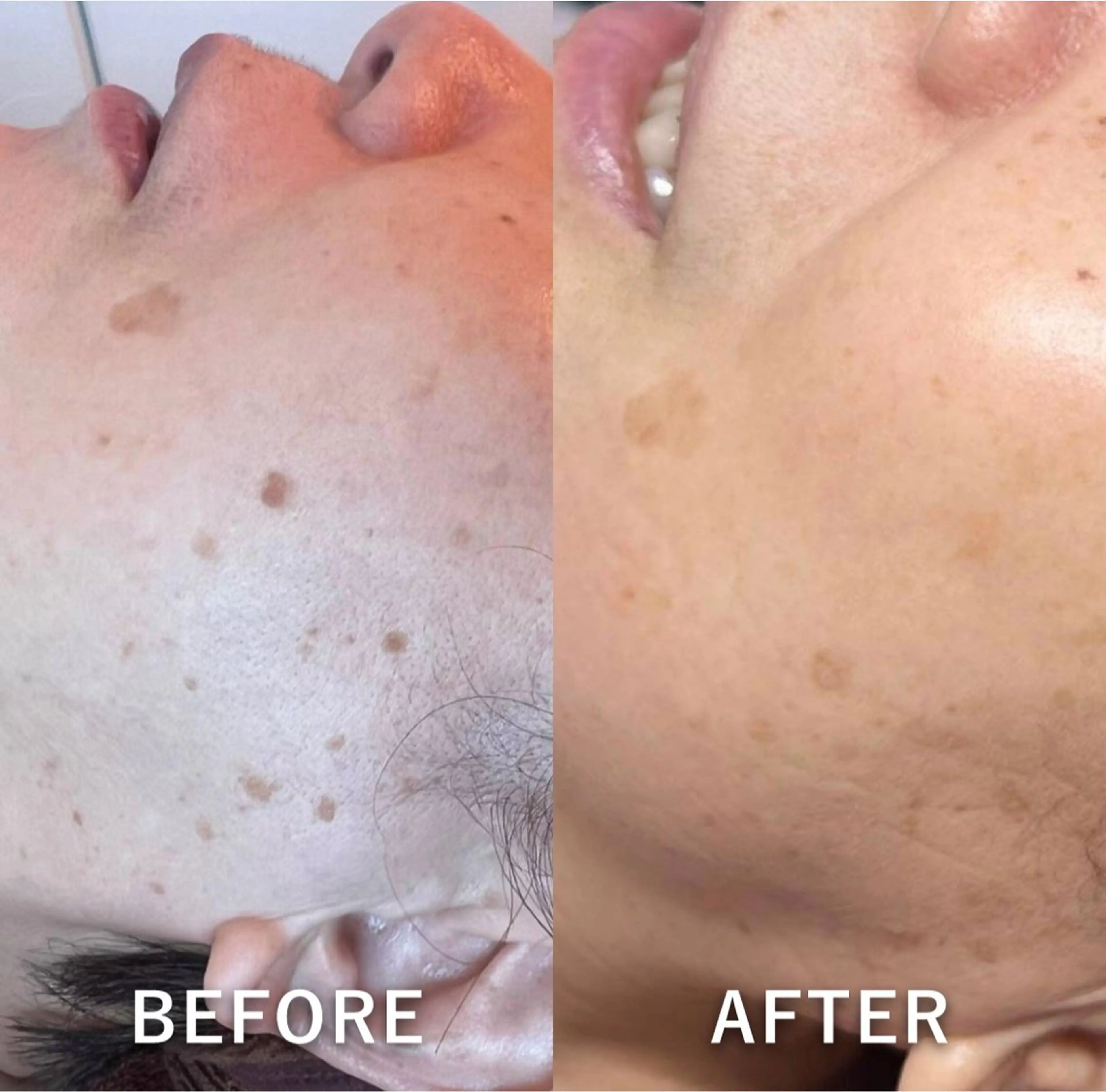 エステ 🌞シミケアサロン @SUNiko🌴のエステ・リラクイメージ