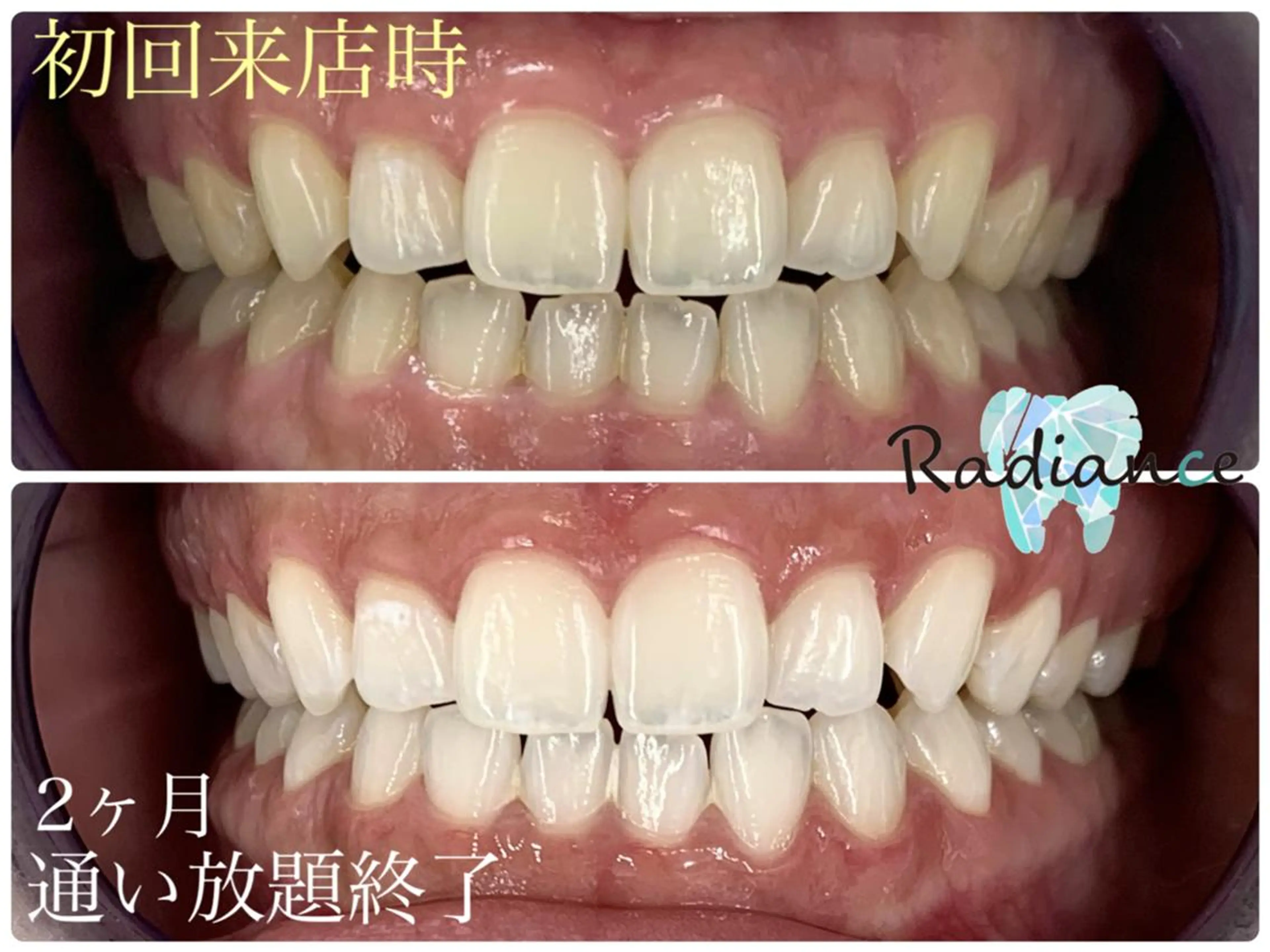 札幌ホワイトニング ラディアンス菊水店のその他イメージ