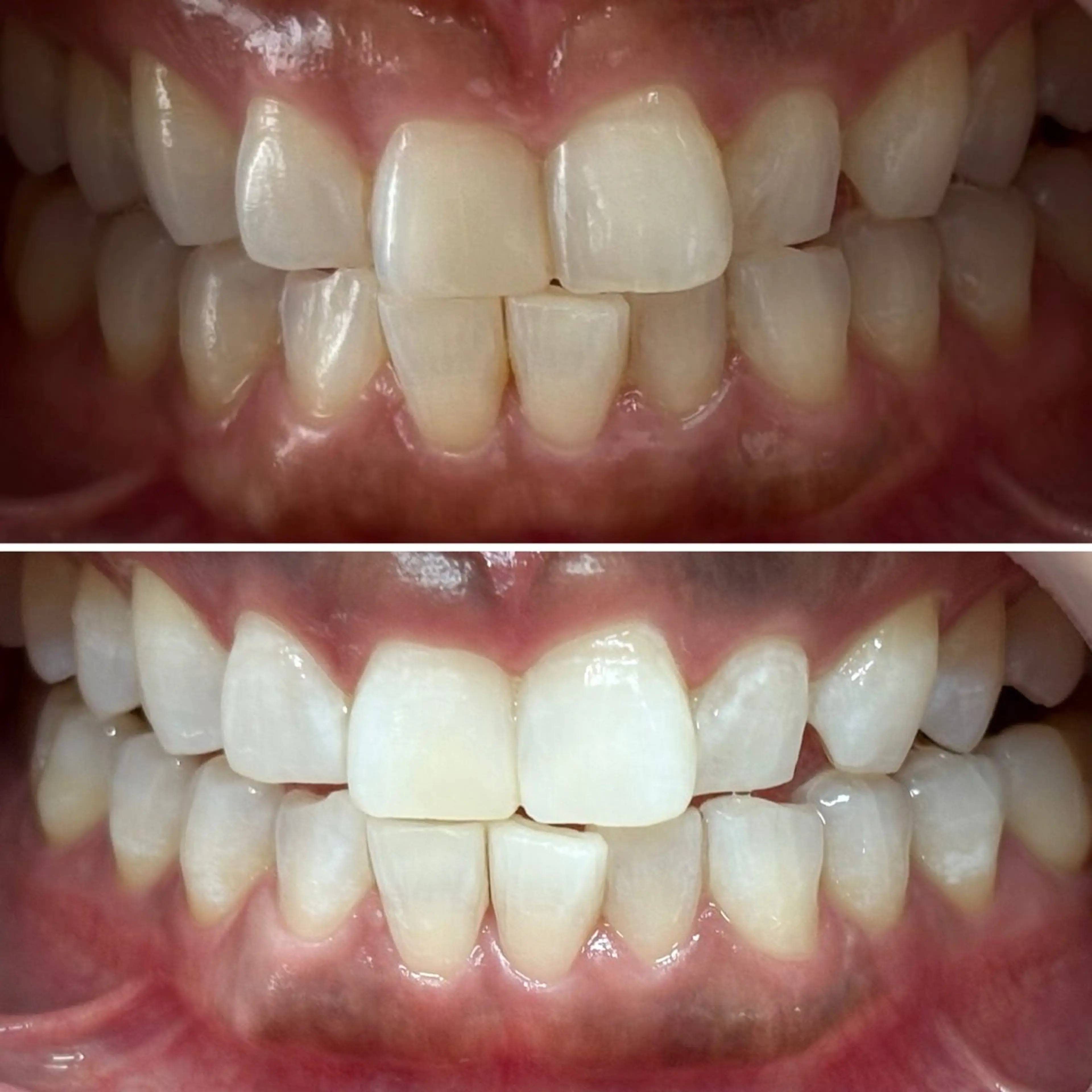 ホワイトニングサロン yatto.のその他イメージ