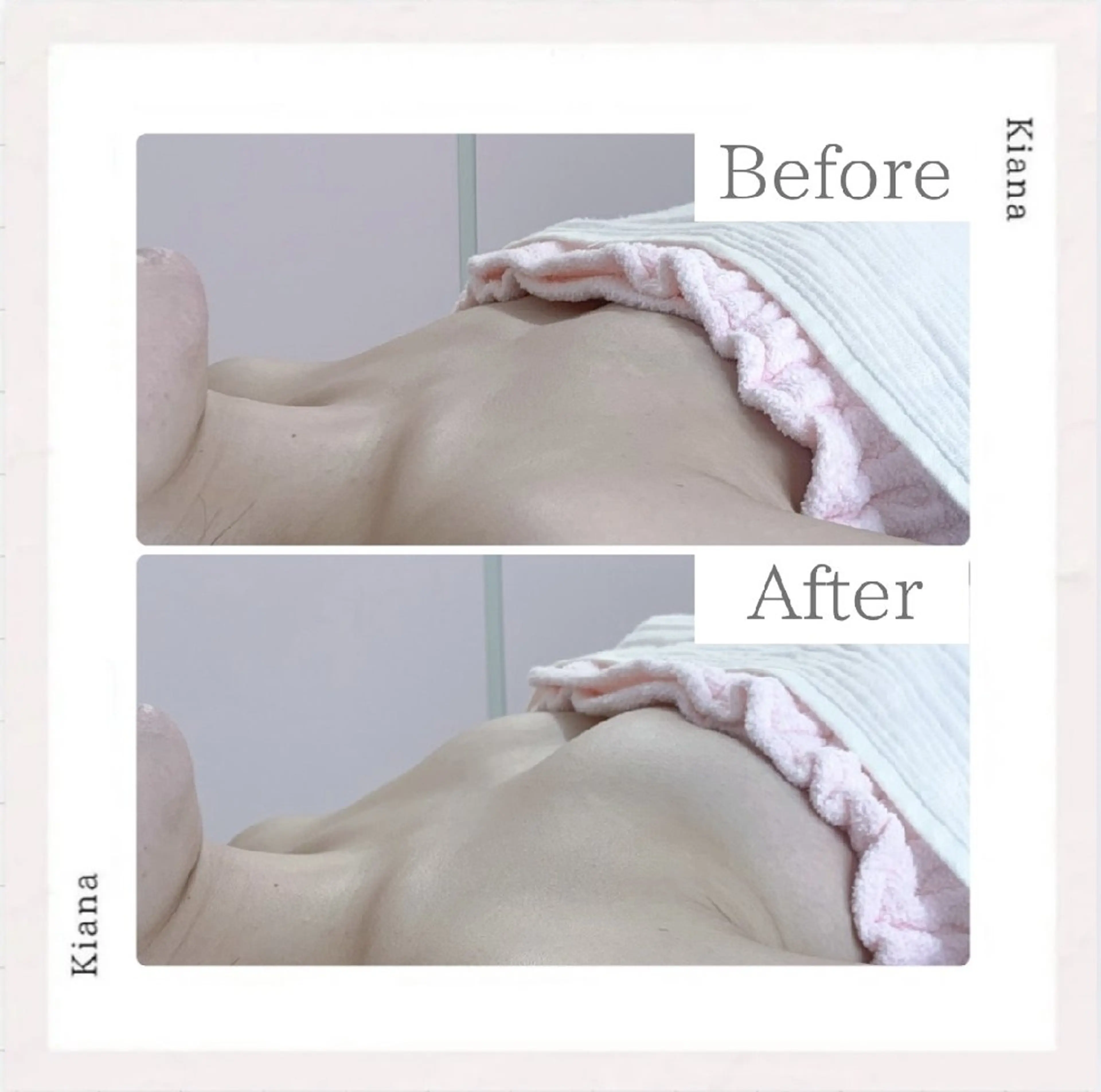 エステ リラク 【バスト専門店 】 Kiana のエステ・リラクイメージ