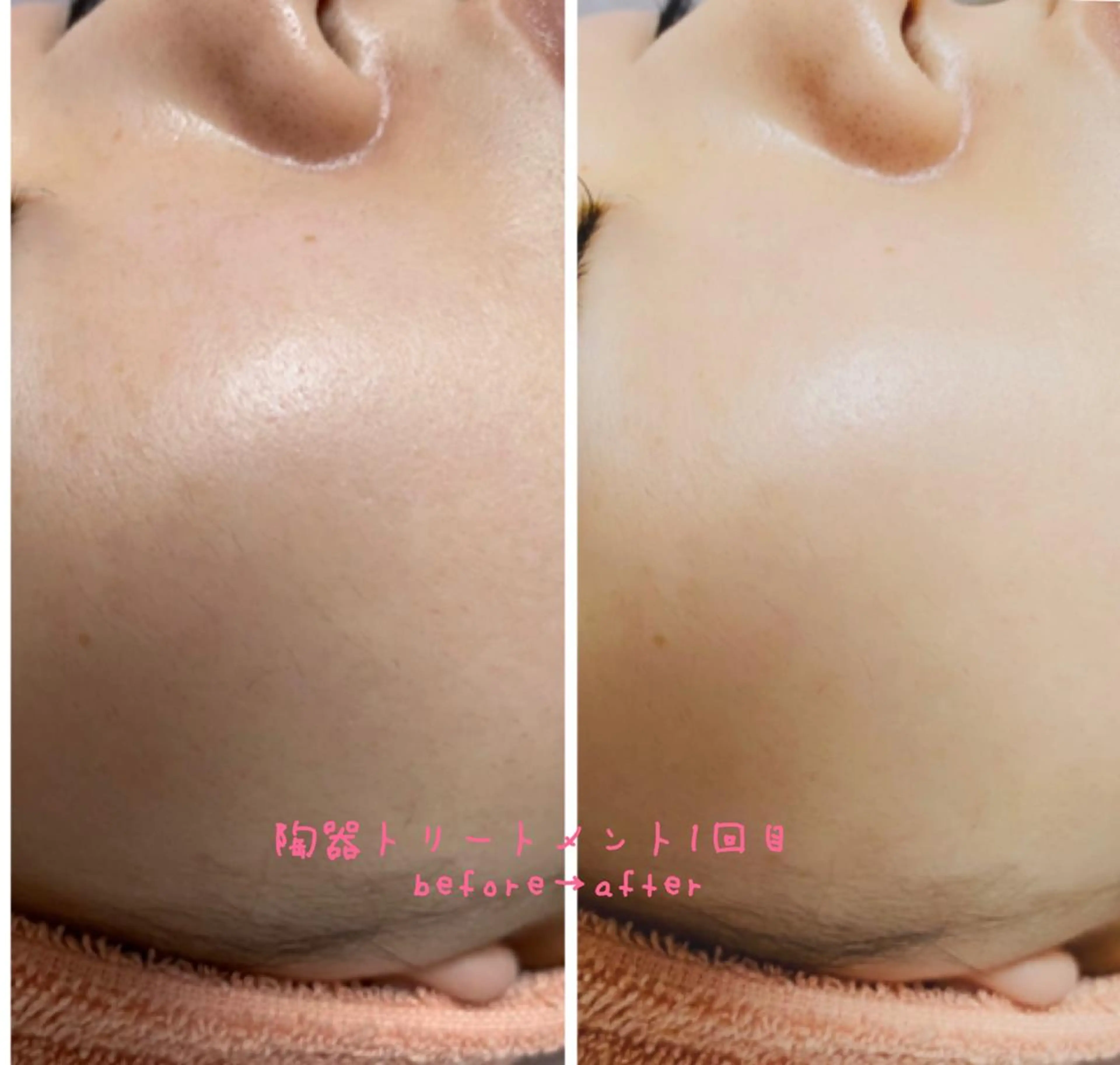 eye lash Lapisのマツエク・マツパデザイン