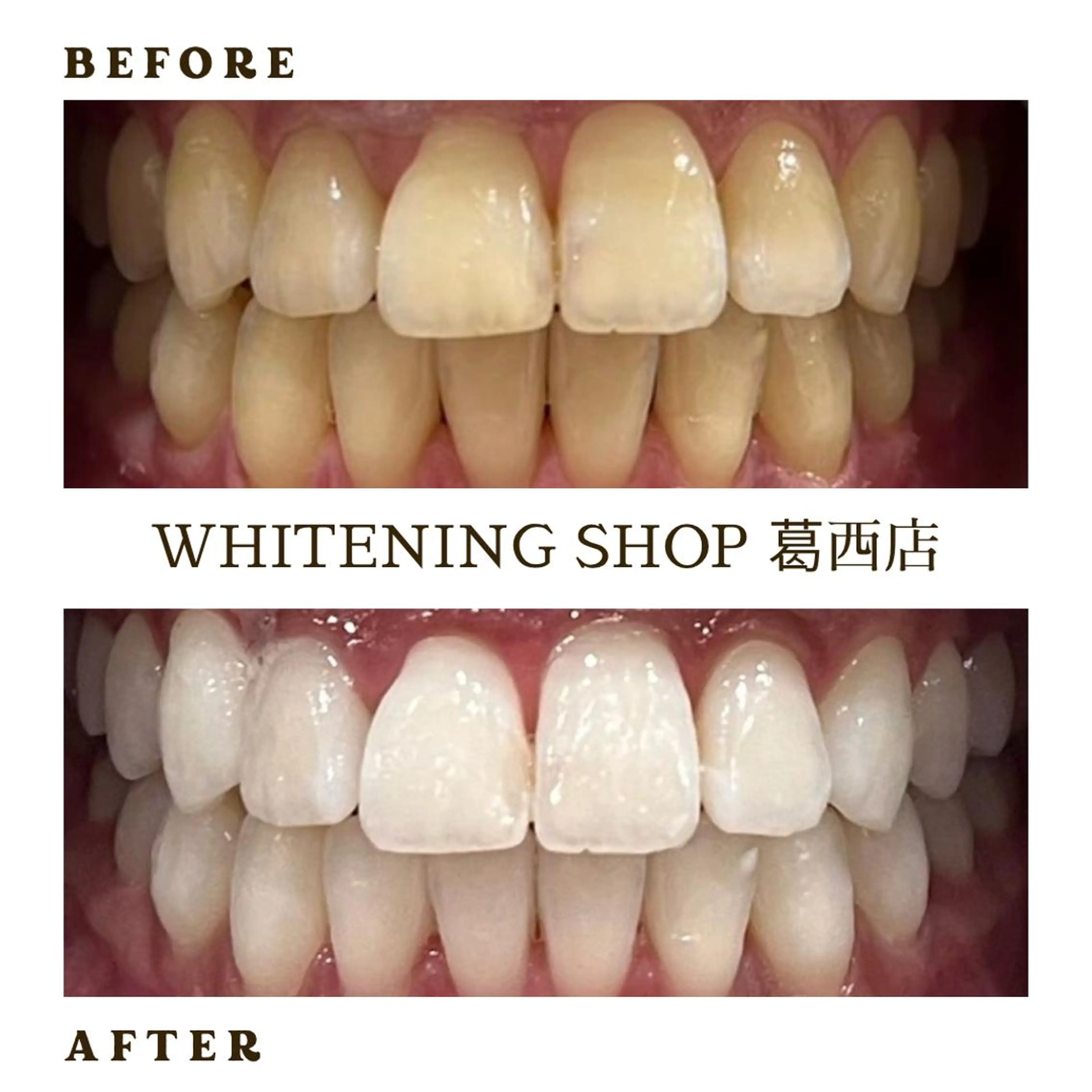 メンズ キッズ その他 ホワイトニング ショップ葛西店のその他イメージ