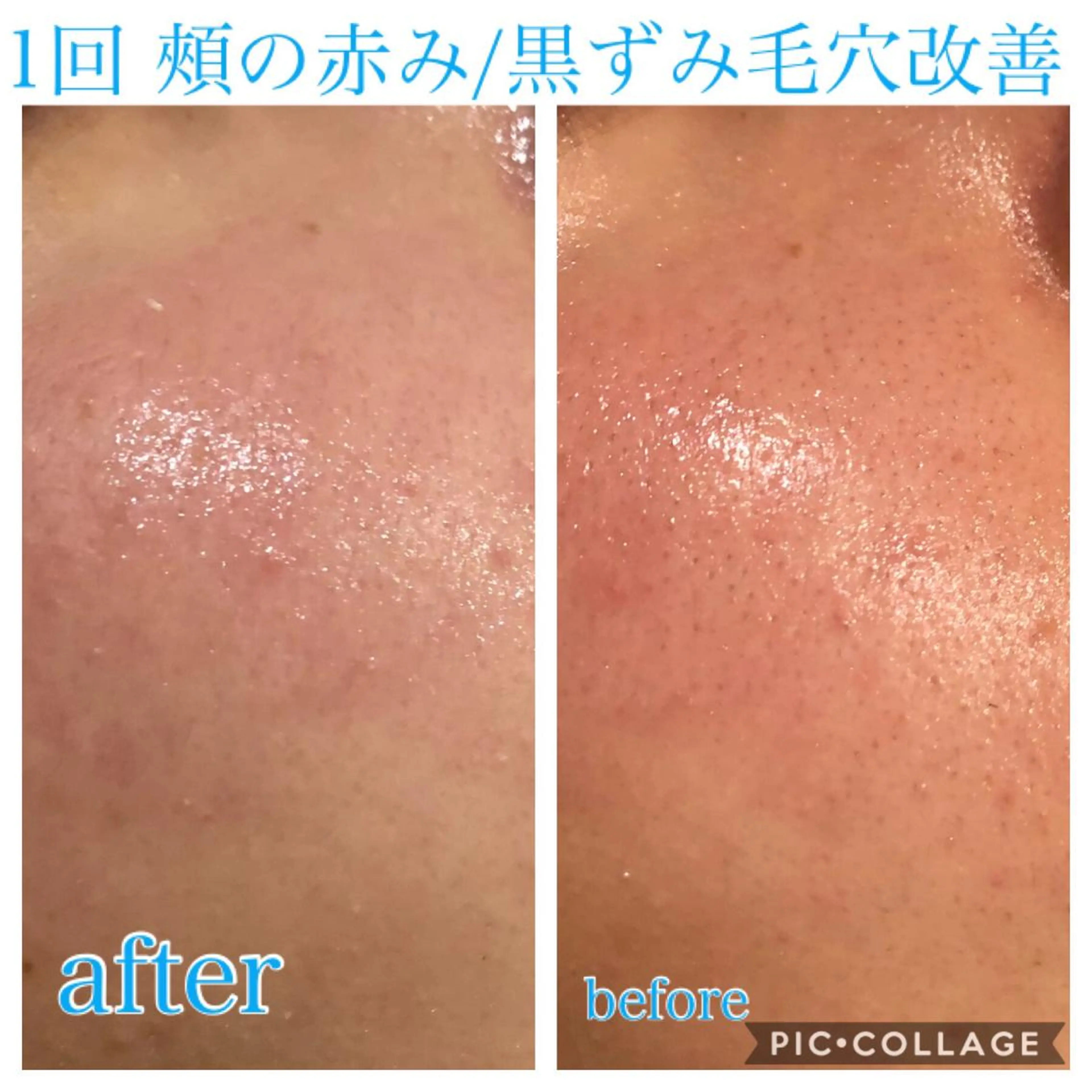 ミディアム カラー パーマ ヘアアレンジ キッズ ネイル マツエク・マツパ エステ リラク EnsorClair 代表 野口真央のエステ・リラクイメージ