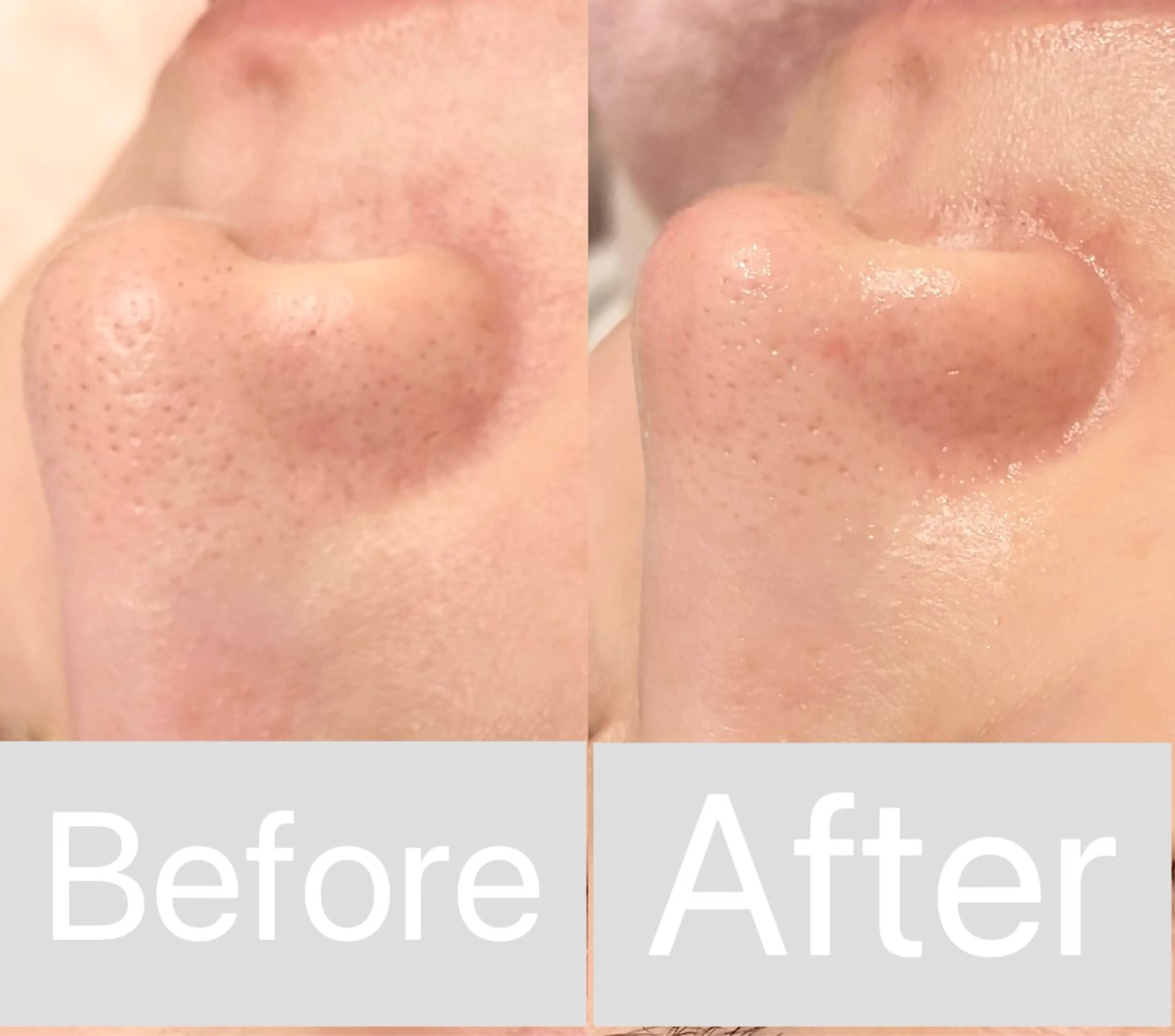 エステ 小顔&毛穴・肌質改善 LINDA西宮 AIのエステ・リラクイメージ