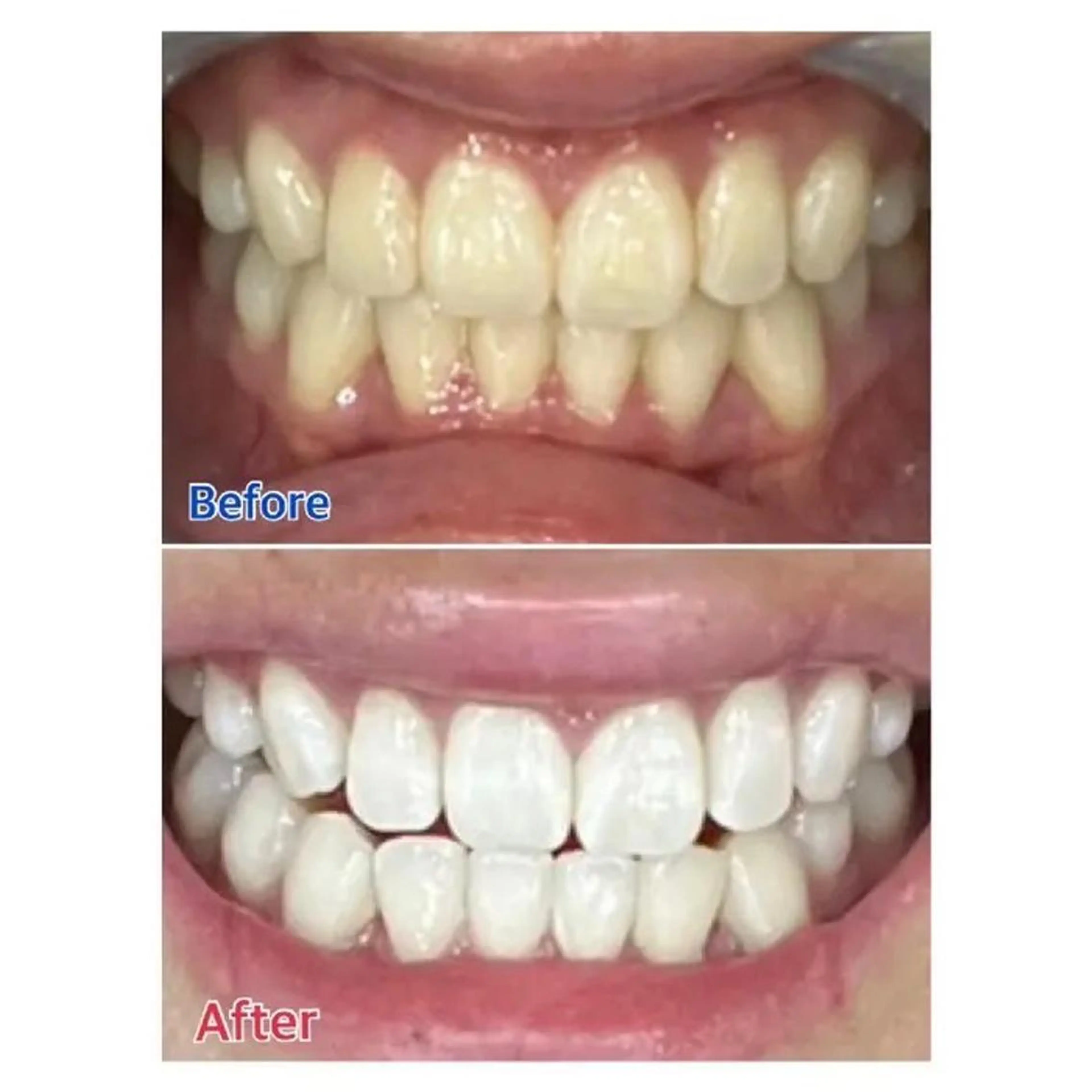 M渋谷 ホワイトニングのエステ・リラクイメージ