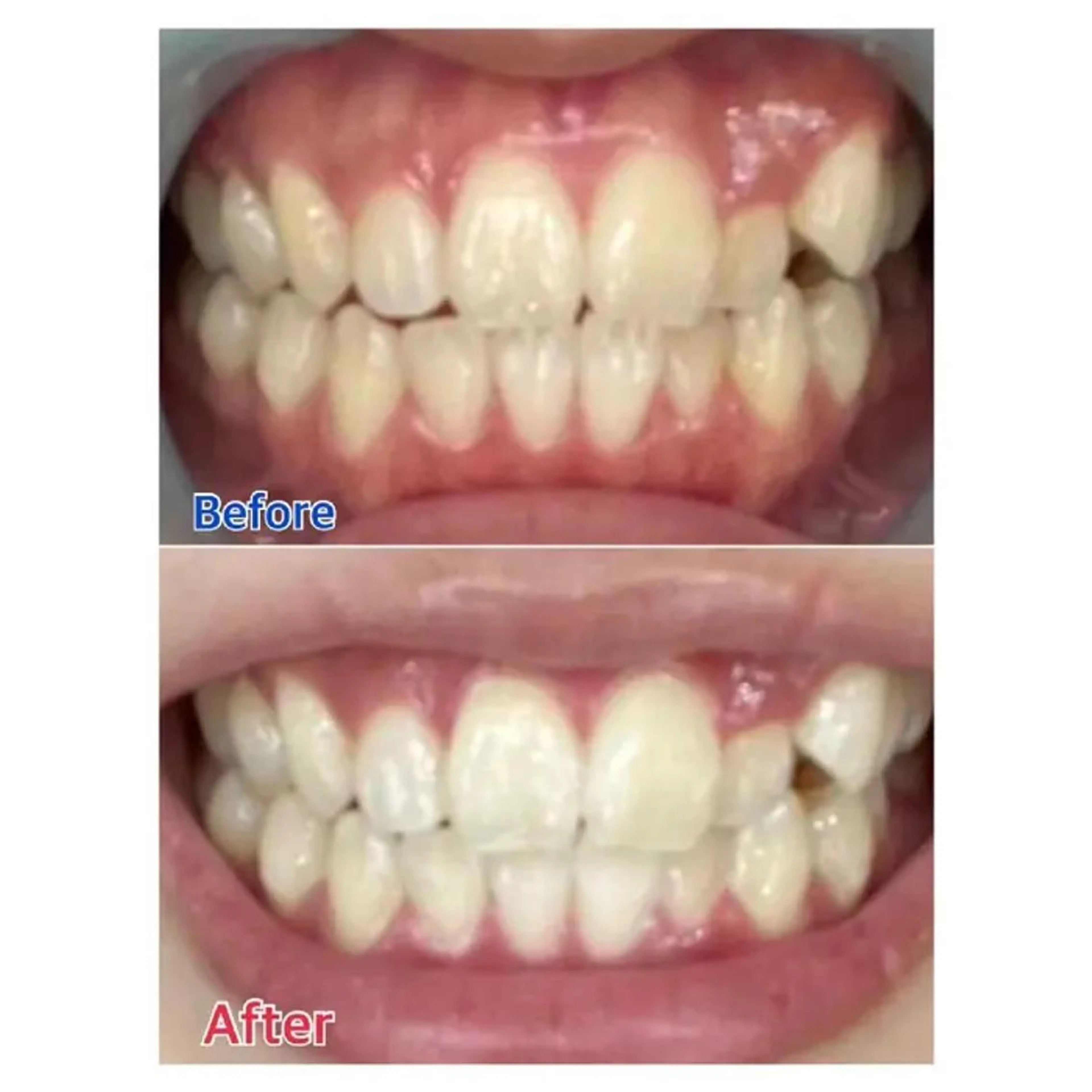 M渋谷 ホワイトニングのエステ・リラクイメージ