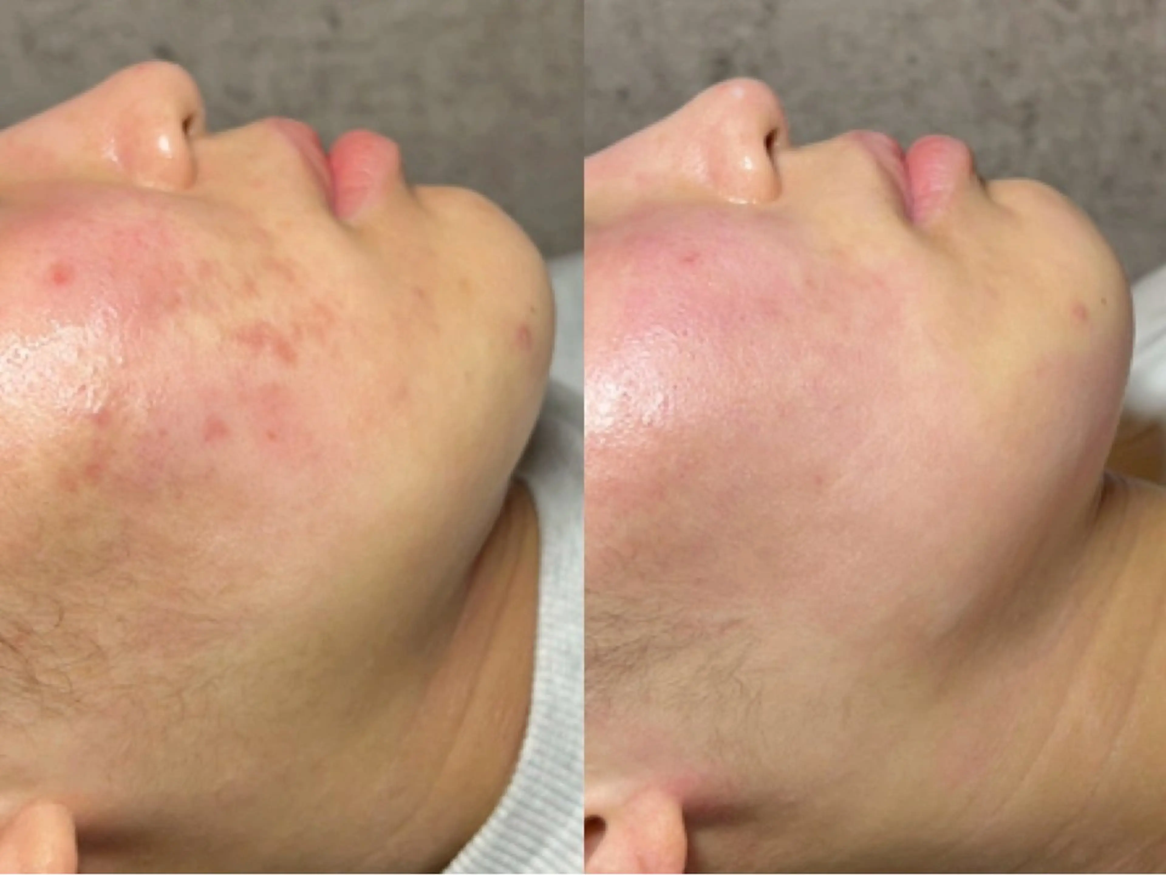 エステ ニキビ・毛穴・肌荒れ &me 西宮北口店のその他イメージ