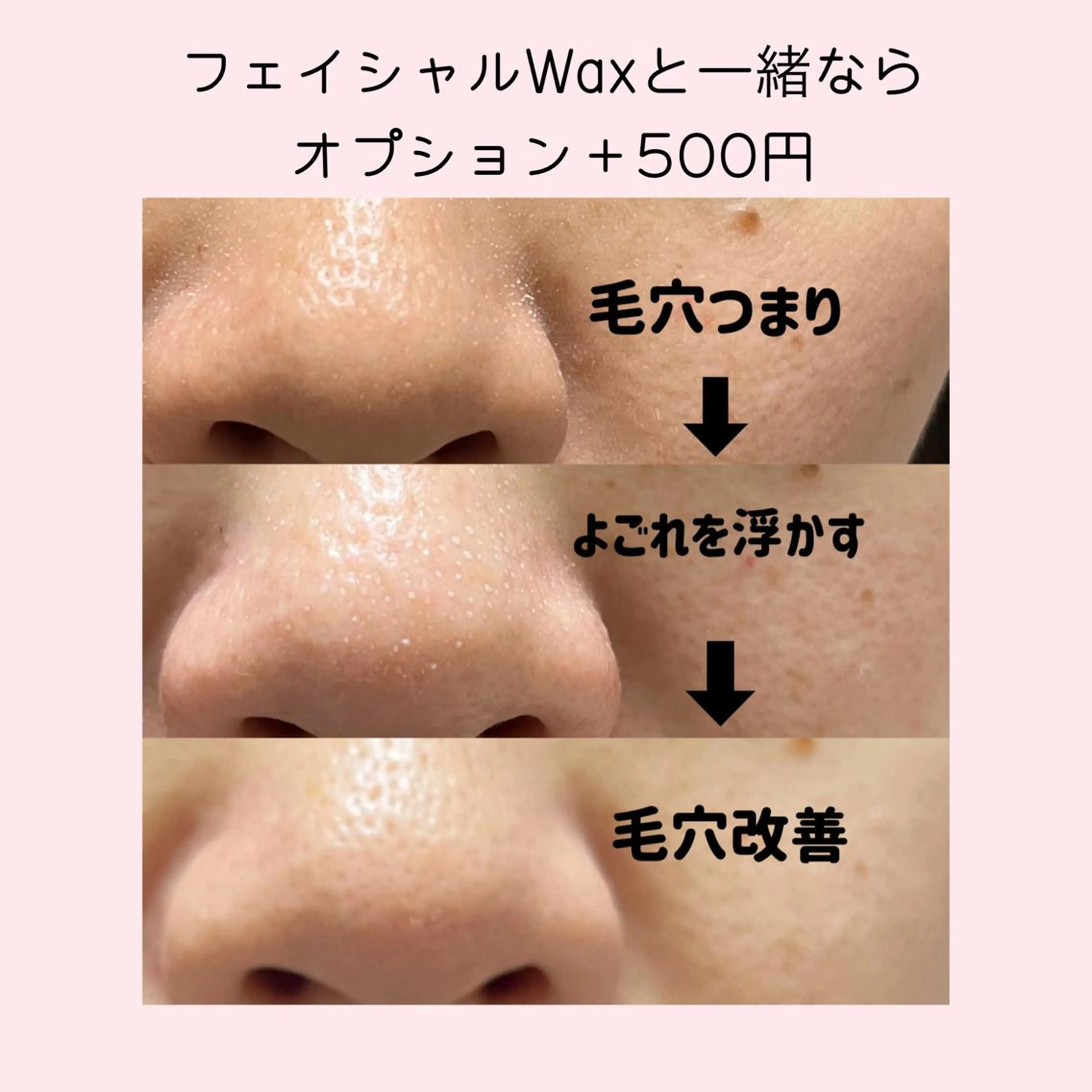 脱毛サロン KiWiのエステ・リラクイメージ