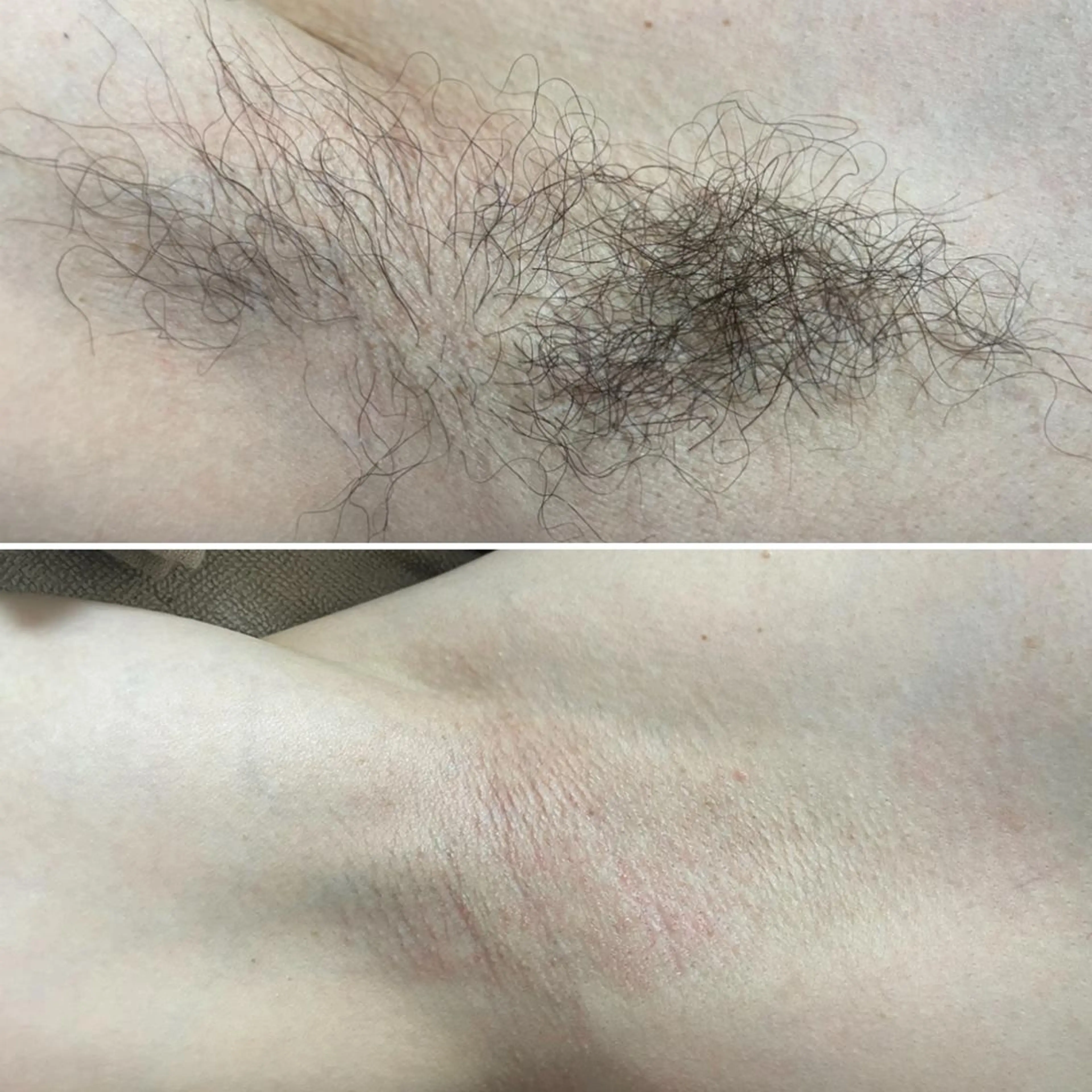 アイブロウ メンズ キッズ 脱毛 Epina 千葉店 【エピナ】のエステ・リラクイメージ