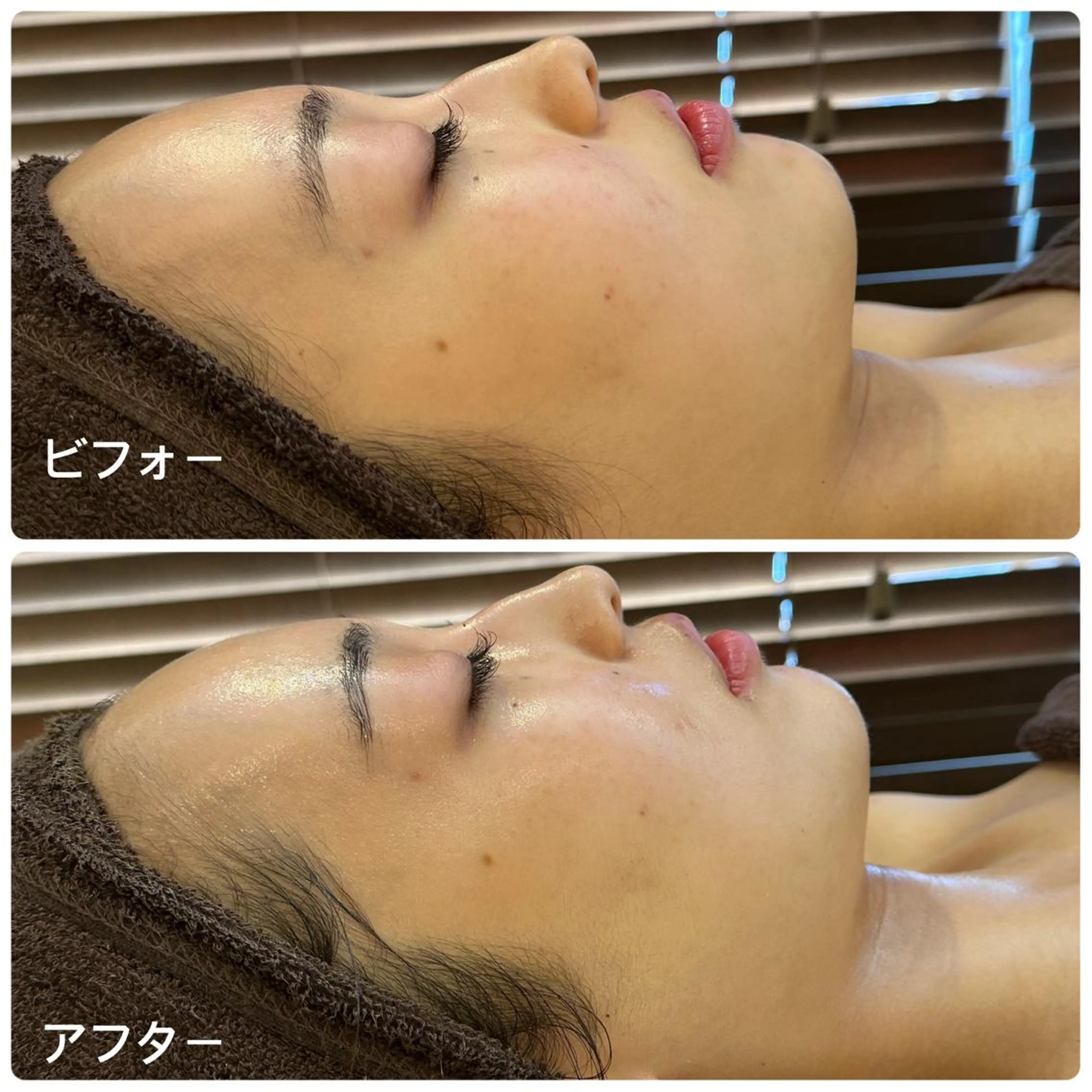 エステ LILY Eのエステ・リラクイメージ