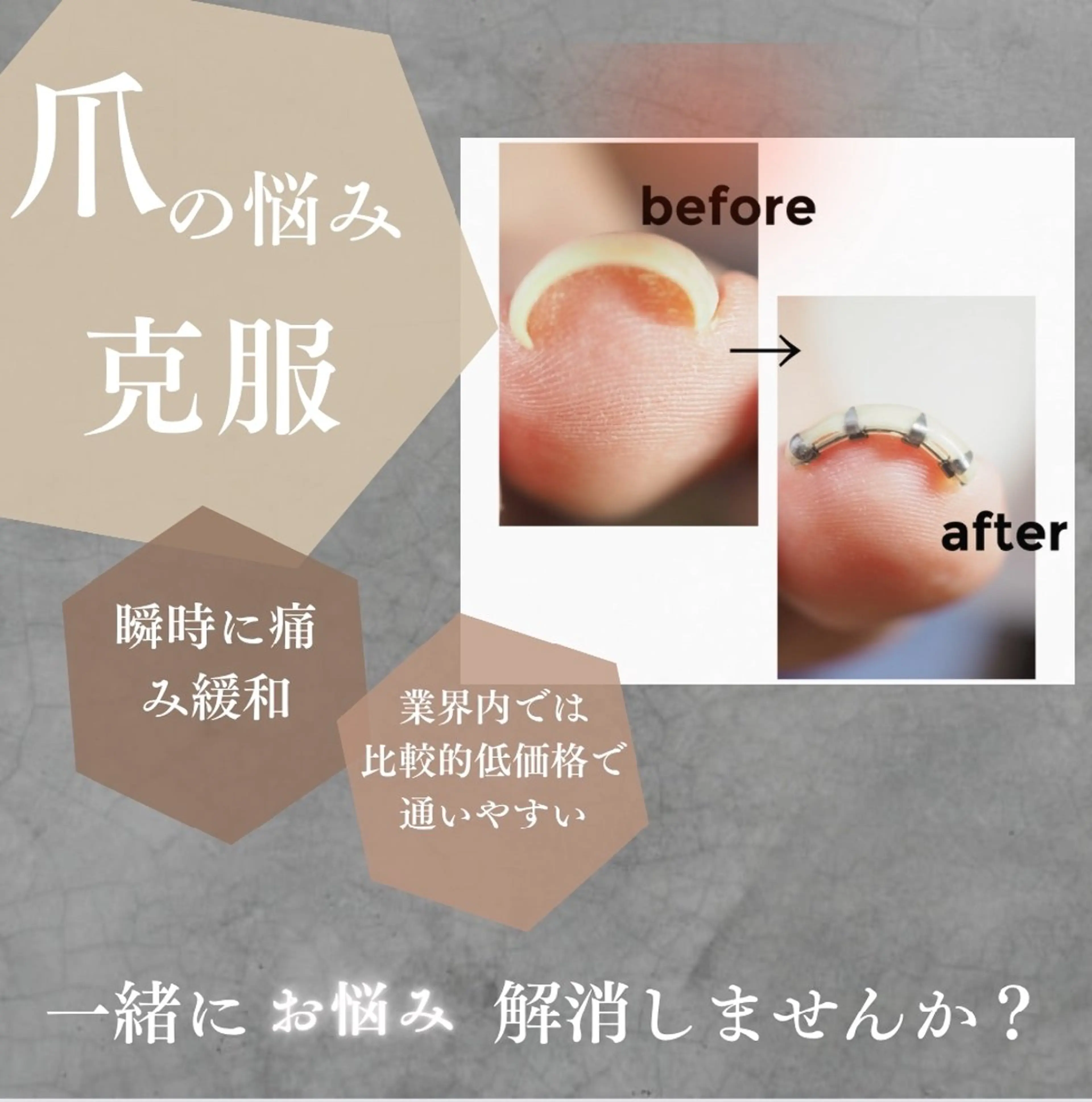 ネイル glaNje 福光のネイルデザイン