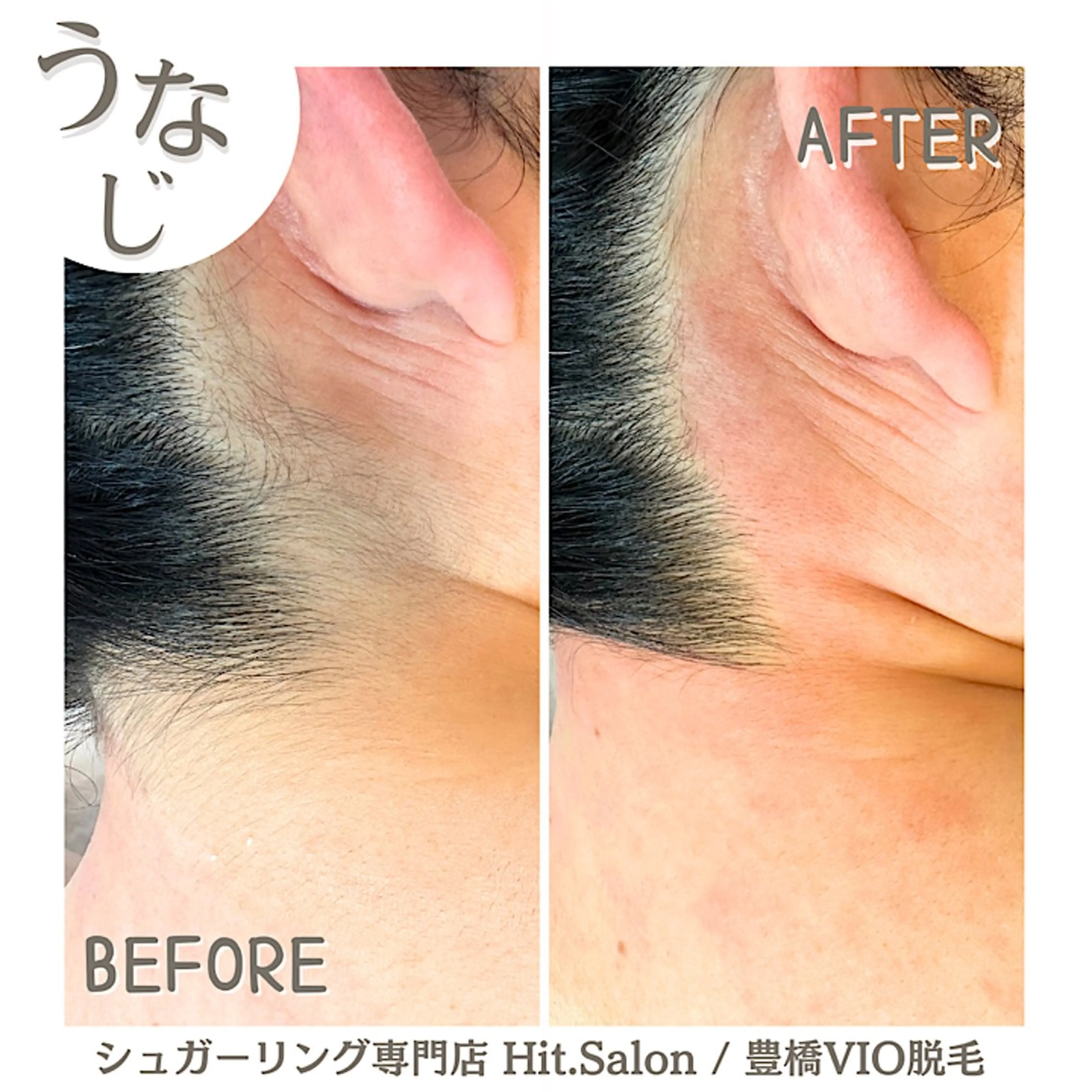 Hitomi シュガーリング豊橋のその他イメージ