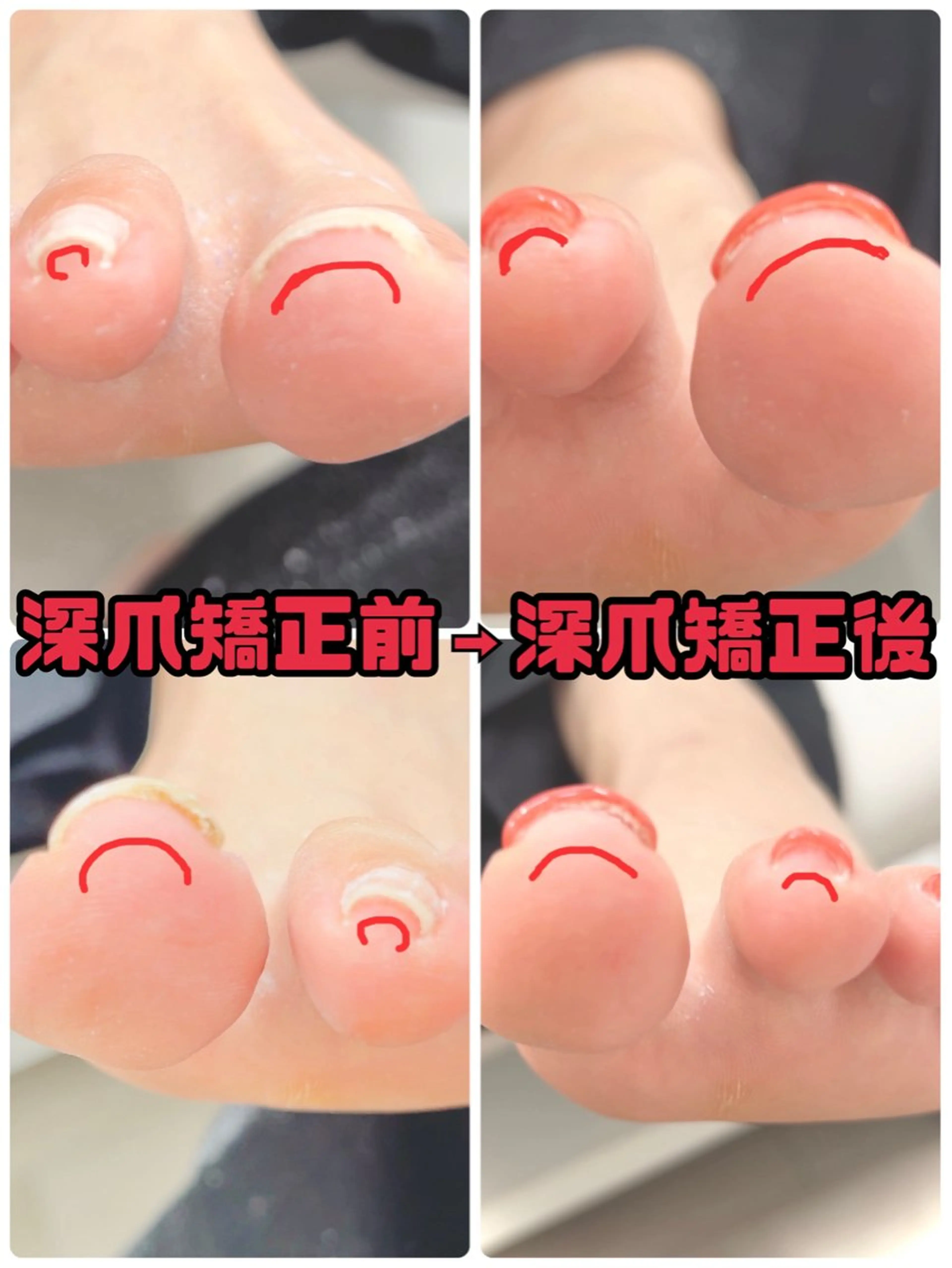ショート ネイル フットネイル RIONnail(リオンネイル)所属・RIONnail Yurikaのネイルデザイン