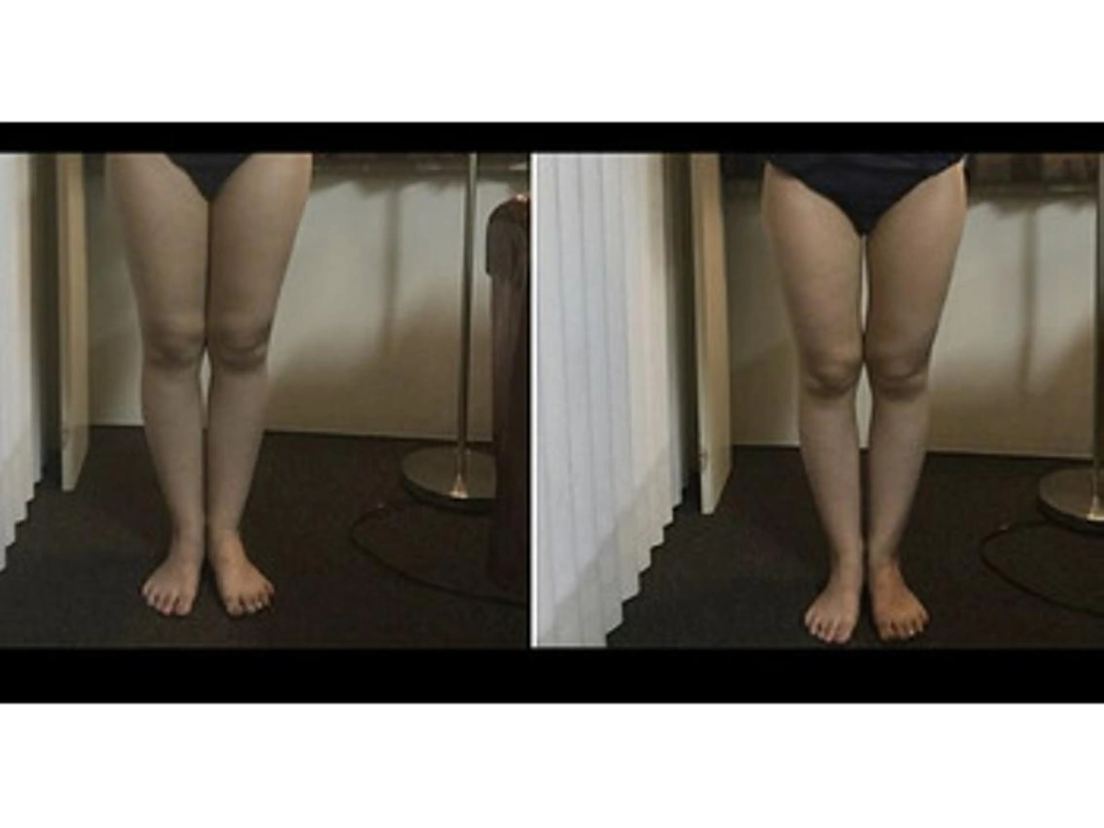 エステ RAYVIS梅田店 FUJIのエステ・リラクイメージ