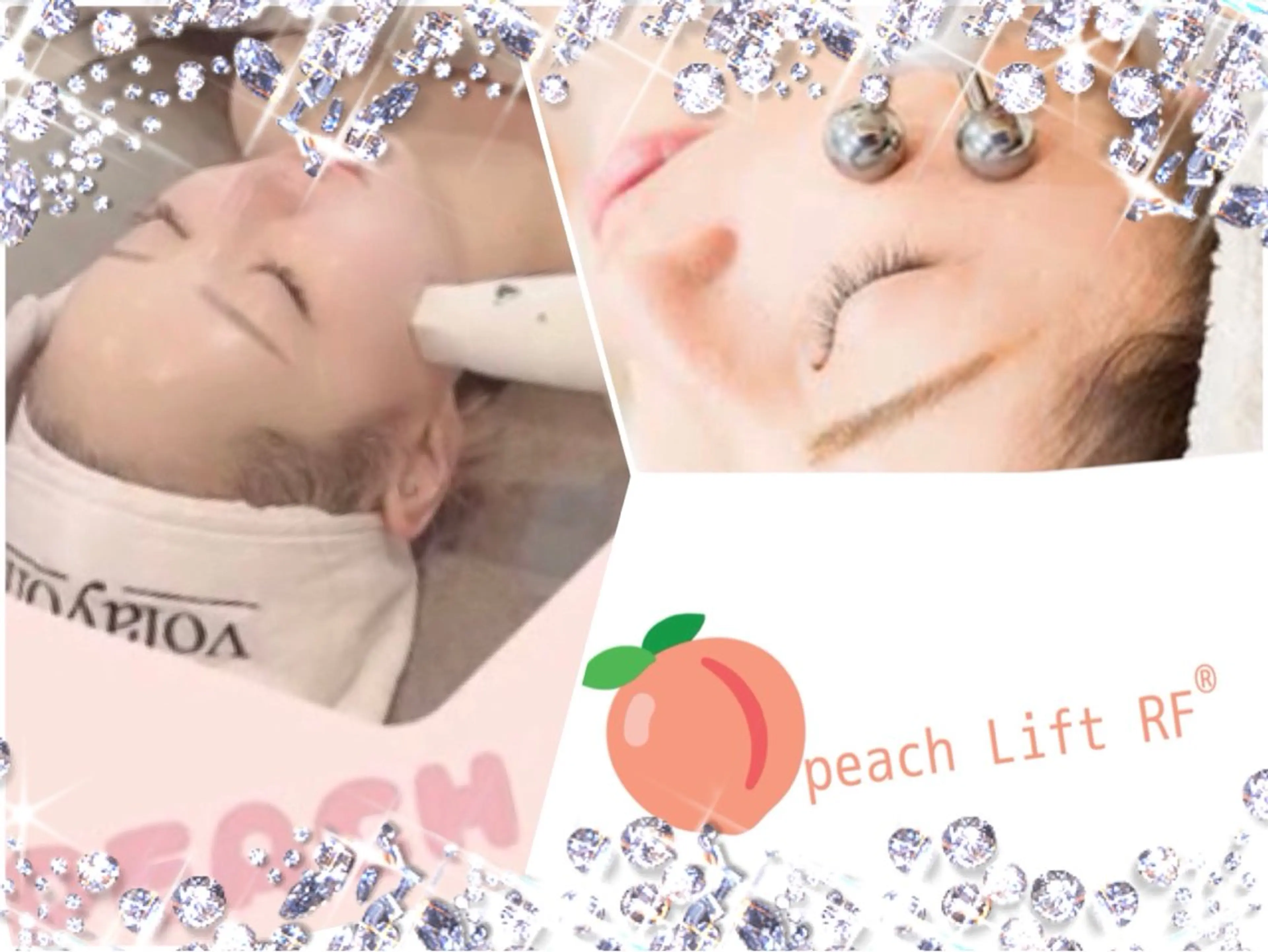 ●『引き締め肌管理』毛穴引き締め 張り ピーチリフトハーフ＆筋膜リフト45分の写真