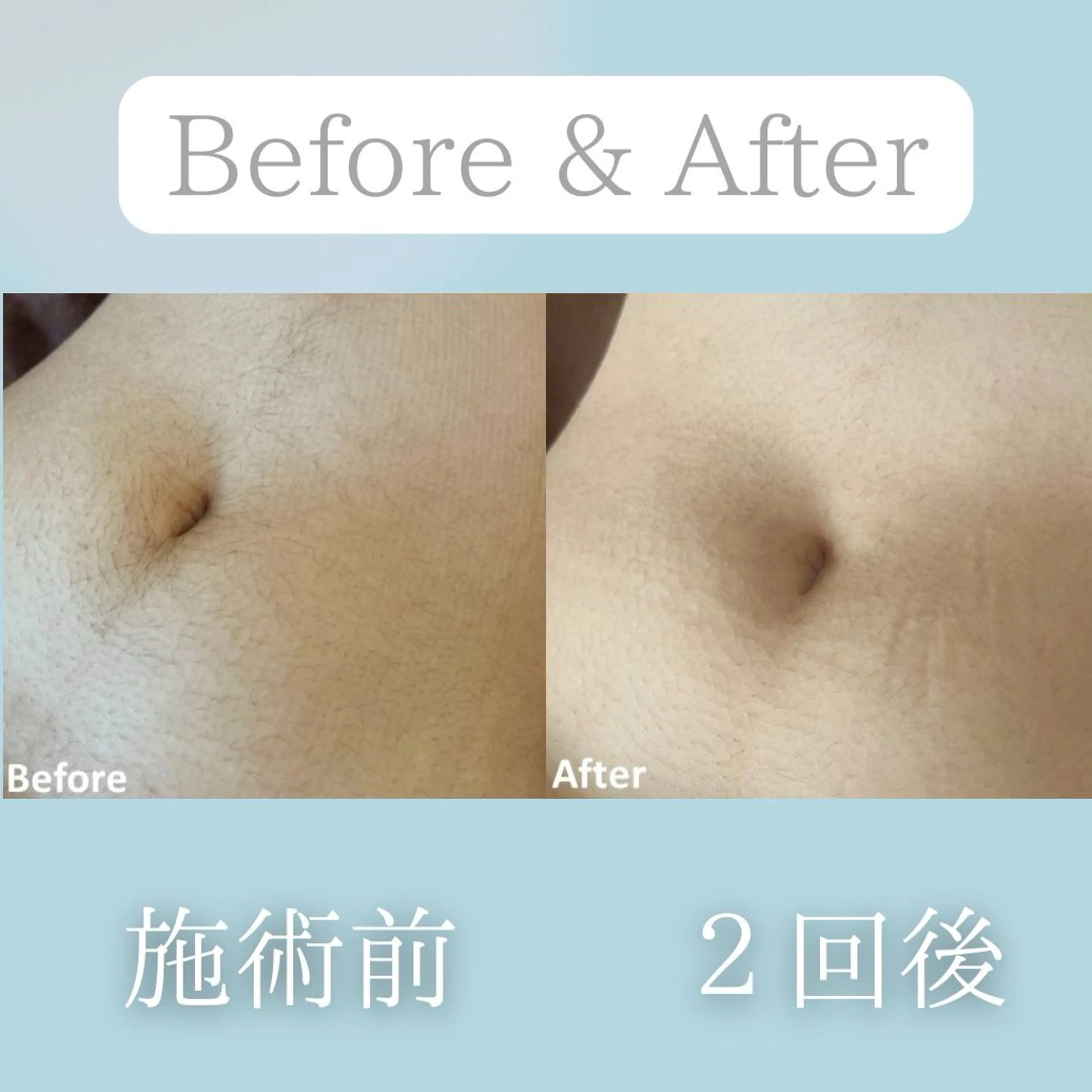 美肌脱毛&毛穴専門 Nico🐰ྀི♡のエステ・リラクイメージ