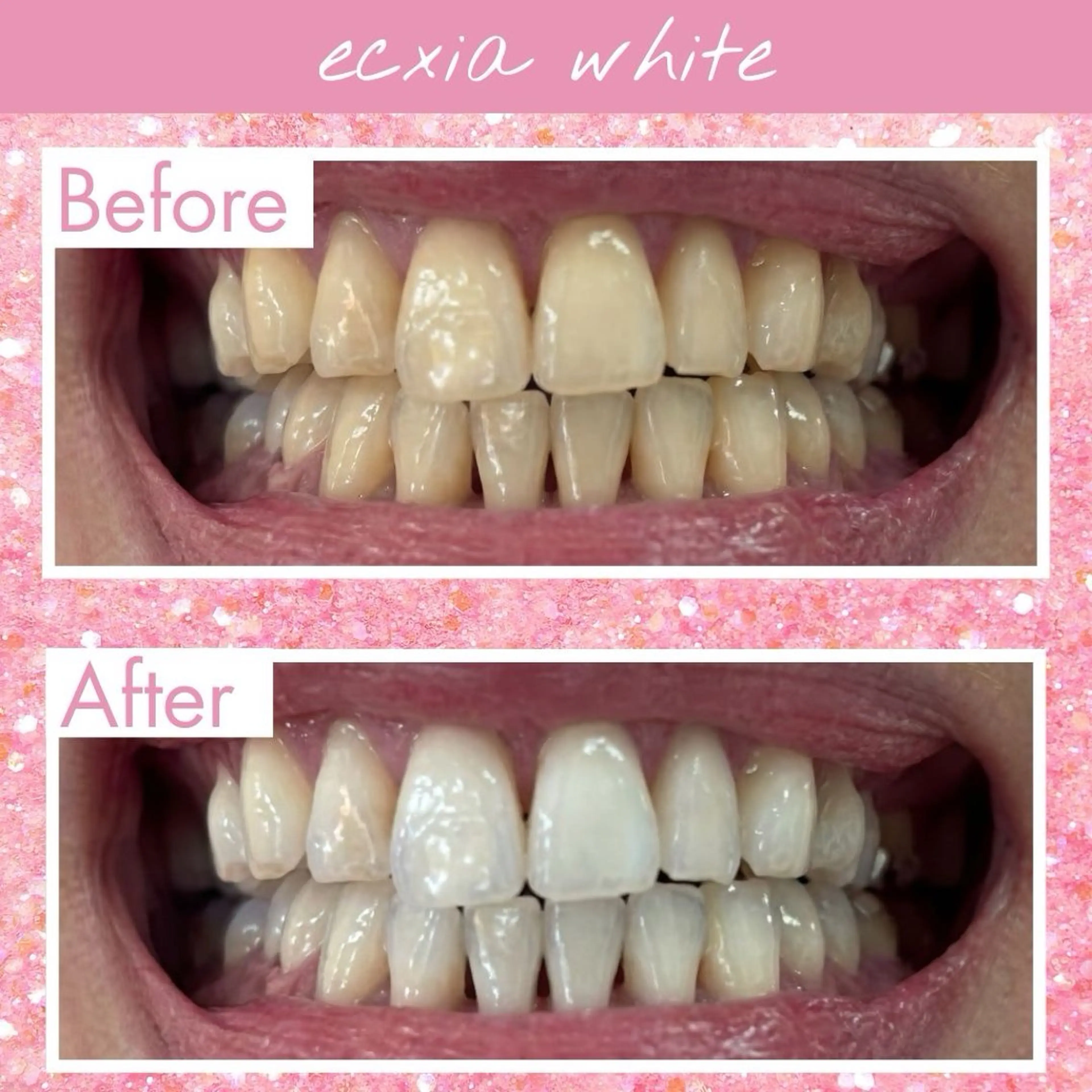 その他 セルフホワイトニング エクシア大府店のその他イメージ